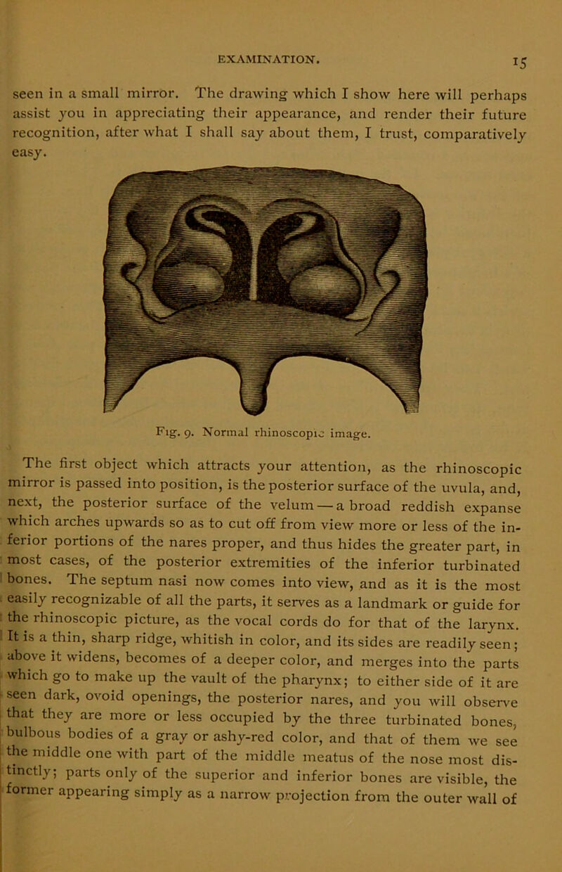 seen in a small mirror. The drawing which I show here will perhaps assist you in appreciating their appearance, and render their future recognition, after what I shall say about them, I trust, comparatively easy. Fig. 9. Normal rhinoscopic image. The first object which attracts your attention, as the rhinoscopic mirror is passed into position, is the posterior surface of the uvula, and, next, the posterior surface of the velum —abroad reddish expanse which arches upwards so as to cut off from view more or less of the in- ferior portions of the nares proper, and thus hides the greater part, in most cases, of the posterior extremities of the inferior turbinated bones. The septum nasi now comes into view, and as it is the most easily recognizable of all the parts, it serves as a landmark or guide for the rhinoscopic picture, as the vocal cords do for that of the larynx. It is a thin, sharp ridge, whitish in color, and its sides are readily seen; above it widens, becomes of a deeper color, and merges into the parts which go to make up the vault of the pharynx; to either side of it are seen dark, ovoid openings, the posterior nares, and you will observe that they are more or less occupied by the three turbinated bones, bulbous bodies of a gray or ashy-red color, and that of them we see the middle one with part of the middle meatus of the nose most dis- tinctly; parts only of the superior and inferior bones are visible, the ormer appearing simply as a narrow projection from the outer wall of