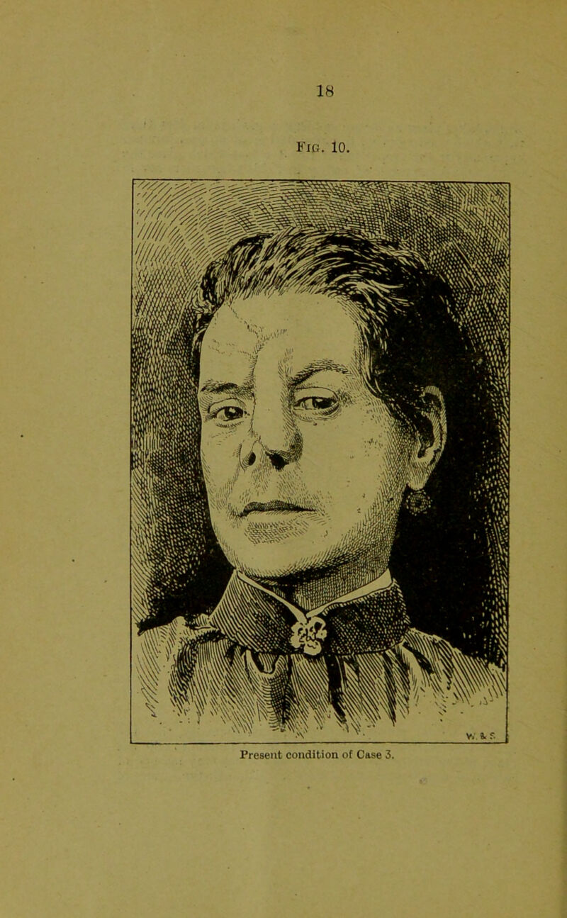 Fig. 10.