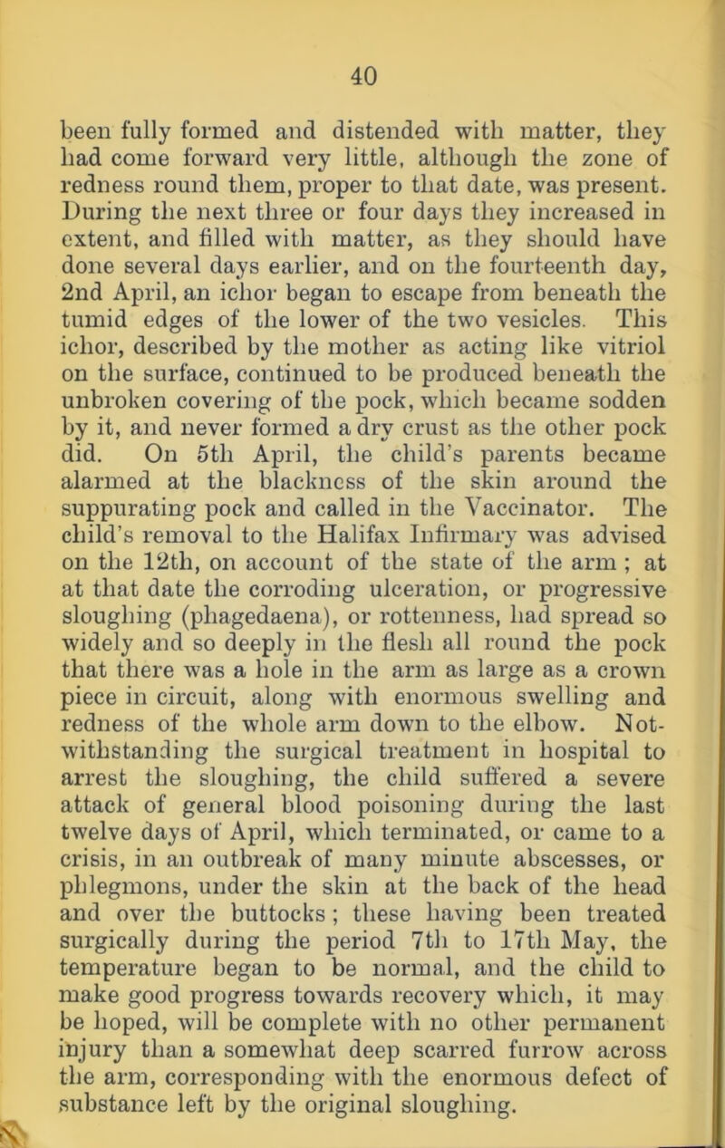 been fully formed and distended with matter, they had come forward very little, although the zone of redness round them, proper to that date, was present. During the next three or four days they increased in extent, and filled with matter, as they should have done several days earlier, and on the fourteenth day, 2nd April, an ichor began to escape from beneath the tumid edges of the lower of the two vesicles. This ichor, described by the mother as acting like vitriol on the surface, continued to be produced beneath the unbroken covering of tbe pock, which became sodden by it, and never formed a dry crust as the other pock did. On 5th April, the child’s parents became alarmed at the blackness of the skin around the suppurating pock and called in the Vaccinator. The child’s removal to the Halifax Infirmary was advised on the 12th, on account of the state of the arm ; at at that date the corroding ulceration, or progressive sloughing (phagedaena), or rottenness, had spread so widely and so deeply in the flesh all round the pock that there was a hole in the arm as large as a crown piece in circuit, along with enormous swelling and redness of the whole arm down to the elbow. Not- withstanding the surgical treatment in hospital to arrest the sloughing, the child suffered a severe attack of general blood poisoning during the last twelve days of April, which terminated, or came to a crisis, in an outbreak of many minute abscesses, or phlegmons, under the skin at the back of the head and over the buttocks; these having been treated surgically during the period 7th to 17th May, the temperature began to be normal, and the child to make good progress towards recovery which, it may be hoped, will be complete with no other permanent injury than a somewhat deep scarred furrow across the arm, corresponding with the enormous defect of substance left by the original sloughing.