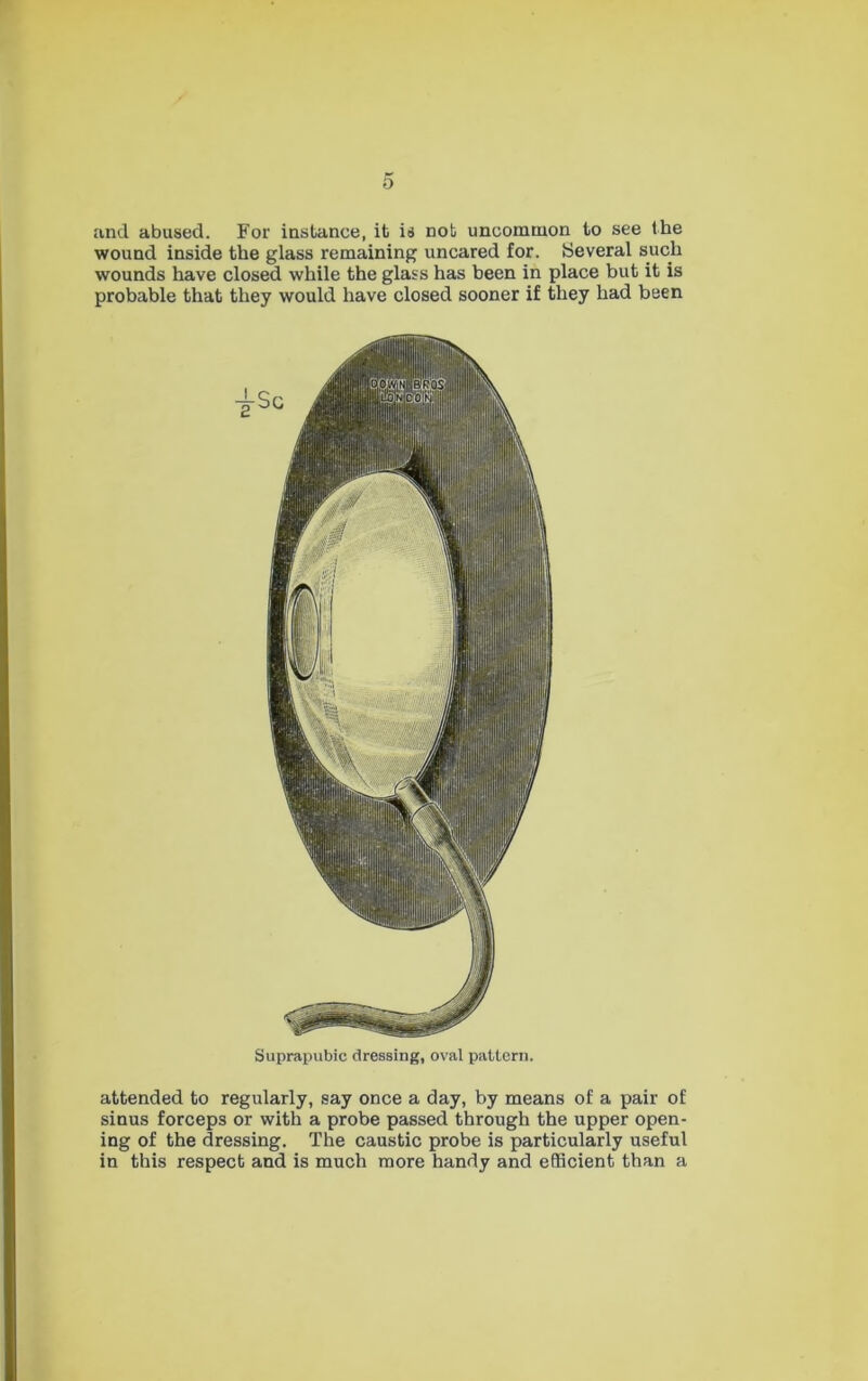 o and abused. For instance, it is not uncommon to see the wound inside the glass remaining uncared for. Several such wounds have closed while the glass has been in place but it is probable that they would have closed sooner if they had been Suprapubic dressing, oval pattern. attended to regularly, say once a day, by means of a pair of sinus forceps or with a probe passed through the upper open- ing of the dressing. The caustic probe is particularly useful in this respect and is much more handy and efficient than a