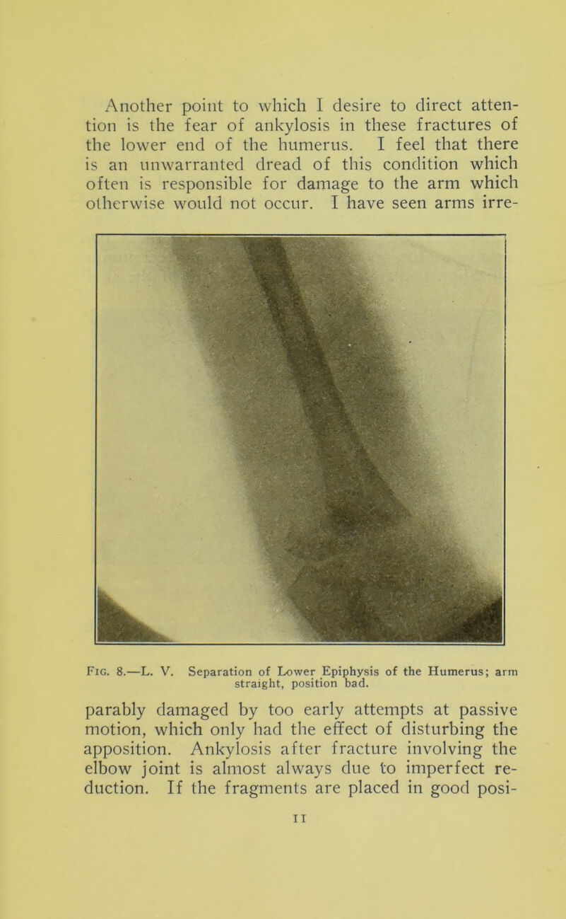 Another point to which I desire to direct atten- tion is the fear of ankylosis in these fractures of the lower end of the humerus. I feel that there is an unwarranted dread of this condition which often is responsible for damage to the arm which otherwise would not occur. I have seen arms irre- Fig. 8.—L. V. Separation of Lower Epiphysis of the Humerus; arm straight, position bad. parably damaged by too early attempts at passive motion, which only had the effect of disturbing the apposition. Ankylosis after fracture involving the elbow joint is almost always due to imperfect re- duction. If the fragments are placed in good posi-