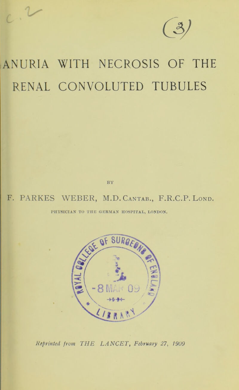 & ANURIA WITH NECROSIS OF THE RENAL CONVOLUTED TUBULES BY F. PARKES WEBER, M.D. Cantab., F.R.C.P. Lond. PHYSICIAN TO THE GERMAN HOSPITAL, LONDON. Reprinted from THE LANCET, February 27, 1909