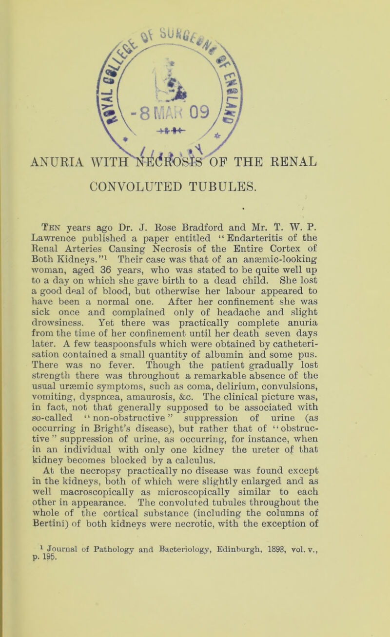 Ten years ago Dr. J. Rose Bradford and Mr. T. W. P. Lawrence published a paper entitled “Endarteritis of the Renal Arteries Causing Necrosis of the Entire Cortex of Both Kidneys.”1 Their case was that of an anaemic-looking woman, aged 36 years, who was stated to be quite well up to a day on which she gave birth to a dead child. She lost a good deal of blood, but otherwise her labour appeared to have been a normal one. After her confinement she was sick once and complained only of headache and slight drowsiness. Yet there was practically complete anuria from the time of her confinement until her death seven days later. A few teaspoonsfuls which were obtained by catheteri- sation contained a small quantity of albumin and some pus. There was no fever. Though the patient gradually lost strength there was throughout a remarkable absence of the usual uraemic symptoms, such as coma, delirium, convulsions, vomiting, dyspnoea, amaurosis, &c. The clinical picture was, in fact, not that generally supposed to be associated with so-called “non-obstructive” suppression of urine (as occurring in Bright’s disease), but rather that of “obstruc- tive ” suppression of urine, as occurring, for instance, when in an individual with only one kidney the ureter of that kidney becomes blocked by a calculus. At the necropsy practically no disease was found except in the kidneys, both of which were slightly enlarged and as well macroscopically as microscopically similar to each other in appearance. The convoluted tubules throughout the whole of the cortical substance (including the columns of Bertini) of both kidneys were necrotic, with the exception of 1 Journal of Pathology and Bacteriology, Edinburgh, 1898, vol. v., p. 195.