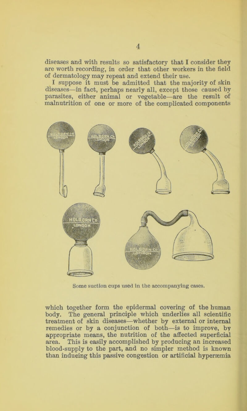 diseases and witli results so satisfactory that I consider they are worth recording, in order that other workers in the field of dermatology may repeat and extend their use. I suppose it must be admitted that the majority of skin diseases—in fact, perhaps nearly all, except those caused by parasites, either animal or vegetable—are the result of malnutrition of one or more of the complicated components Some suction cups used in the accompanying cases. which together form the epidermal covering of the human body. The general principle which underlies all scientific treatment of skin diseases—whether by external or internal remedies or by a conjunction of both—is to improve, by appropriate means, the nutrition of the affected superficial area. This is easily accomplished by producing an increased blood-supply to the part, and no simpler method is known than inducing this passive congestion or artificial hyperaemia