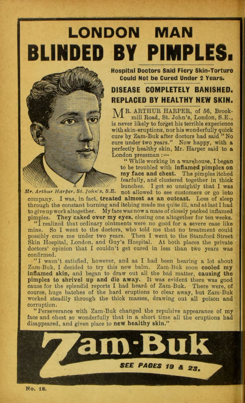 LONDON MAN BLINDED BY PIMPLES. Hospital Doctors Said Fiery Skin-Torture Could Not be Cured Under 2 Years. DISEASE COMPLETELY BANISHED. REPLACED BY HEALTHY NEW SKIN. MR. ARTHUR HARPER, of 56, Brook- mill Road, St. John’s, London, S.E., is never likely to forget his terrible experience with skin-eruptions, nor his wonderfully quick cure by Zam-Buk after doctors had said “ No cure under two years.” Now happy, with a perfectly healthy skin, Mr. Harper said to a London pressman :— “ While working in a warehouse, I began to be troubled with inflamed pimples on my face and chest. The pimples itched fearfully, and clustered together in thick bunches. I got so unsightly that I was Mr. Arthur Harper, St. John's, S.E. noj allowed to see customers or go into company. I was, in fact, treated almost as an outcast. Loss of sleep through the constant burning and itching made me quite ill, and at last I had to give up work altogether. My face was now a mass of closely packed inflamed pimples. They caked over my eyes, closing one altogether for ten weeks. “I realized that ordinary ointments were no good for a severe case like mine. So I went to the doctors, who told me that no treatment could possibly cure me under two years. Then I went to the Stamford Street Skin Hospital, London, and Guy’s Hospital. At both places the private doctors’ opinion that I couldn’t get cured in less than two years was confirmed. “I wasn’t satisfied, however, and as I had been hearing a lot about Zam-Buk, I decided to try this new balm. Zam-Buk soon cooled my inflamed skin, and began to draw out all the bad matter, causing the pimples to shrivel up and die away. It was evident there was good cause for the splendid reports I had heard of Zam-Buk. There were, of course, huge batches of the hard eruptions to clear away, but Zam-Buk worked steadily through the thick masses, drawing out all poison and corruption. “Perseverance with Zam-Buk changed the repulsive appearance of my face and chest so wonderfully that in a short time all the eruptions had disappeared, and given place to new healthy skin.” ianvBuk PAGES No. 18.