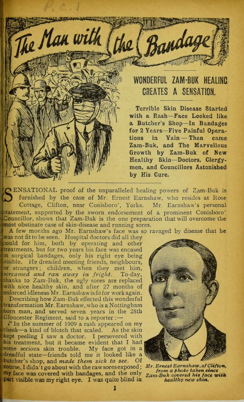 WONDERFUL ZAM-BUK HEALING CREATES A SENSATION. Terrible Skin Disease StartecH with a Rash—Face Looked like a Butcher’s Shop—In Bandages for 2 Years—Five Painful Opera- tions in Yain —Then came Zam-Buk, and The Marvellous Growth by Zam-Buk of New Healthy Skin—Doctors, Clergy- men, and Councillors Astonished by Kis Cure. / \ i SENSATIONAL proof of the unparalleled healing powers of Zam-Buk is furnished by the case of Mr. Ernest Earnshaw, who resides at Rose Cottage, Clifton, near Conisboro', Yorks. Mr. Earnshaw’s personal statement, supported by the sworn endorsement of a prominent Conisboro' Councillor, shows that Zam-Buk is the one preparation that will overcome the most obstinate case of skin-disease and running sores. A few months ago Mr. Earnshaw’s face was so ravaged by disease that he was not fit to be seen. Hospital doctors did all they :ould for him, both by operating and other treatments, but for two years his face was encased :n surgical bandages, only his right eye being visible. He dreaded meeting friends, neighbours, or strangers; children, when they met him, screamed and ran away in fright. To-day, thanks to Zam-Buk, the ugly sores are replaced with nice healthy skin, and after 27 months of enforced idleness Mr. Earnshaw is fit for workagain. Describing how Zam-Buk effected this wonderful transformation Mr. Earnshaw,who is a Nottingham jborn man, and served seven years in the 28th iGloucester Regiment, said to a reporter :—• ’ In the summer of 1909 a rash appeared on my jeheek—a kind of blotch that scaled. As the skin kept peeling I saw a doctor. I persevered with his treatment, but it became evident that I had i isome serious skin trouble. My face got in a j dreadful state—friends told me it looked like a 1 butcher's shop, and made them sick to see. Of course, I didn't go about with the raw sores exposed; Mr. Ernest Earnshaw, of Clifton, ray face was covered wffh bandages, and the only Za,n-Buk covered his face with