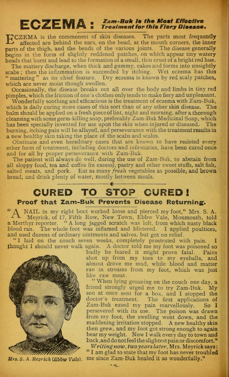 ECZEM A: Zam-Buk is the Meet Effective Treatment for this Fiery Disease* Eczema is the commonest of skin diseases. The parts most frequently affected are behind the ears, on the head, at the mouth corners, the inner parts of the thigh, and the bends of the various joints. The disease generally begins in the form of slightly reddened patches, on which appear tiny watery heads that burst and lead to the formation of a small, thin crust of a bright red hue. The mattery discharge, when thick and gummy, cakes and forms into unsightly scabs ; then the inflammation is succeeded by itching. Wet eczema has this “ mattering ” as its chief feature. Dry eczema is known by red scaly patches, which are never moist though swollen. Occasionally, the disease breaks out all over the body and limbs in tiny red pimples, which the friction of one’s clothes only tends to make fiery and unpleasant. Wonderfully soothing and efficacious is the treatment of eczema with Zam-Buk, which is daily curing more cases of this sort than of any other skin disease. The balm should be applied on a fresh pieceof lint, night and morning, after a thorough cleansingwith some germ-killing soap, preferably Zam-Buk Medicinal Soap, which has been specially invented for use upon the skin when injured or diseased. The burning, itching pain will be allayed, and perseverance with the treatment results in a new healthy skin taking the place of the scabs and scales. Obstinate and even hereditary cases that are known to have resisted every other form of treatment, including doctors and infirmaries, have been cured once and for all by proper perseverance with Zam-Buk. The patient will always dc well, during the use of Zam-Buk, to abstain from all sloppy food, tea and coffee (in excess), pastry and other sweet stuffs, salt fish, salted meats, and pork. Eat as many fresh vegetables as possible, and brown bread, and drink plenty of water, mostly between meals. ♦ CURED TO STOP CURED! Proof that Zam-Buk Prevents Disease Returning. “ A NAIL in my right boot worked loose and pierced my foot,” Mrs. S. A. Meyrick, of 17, Fifth Row, New Town, Ebbw Vale, Monmouth, told a Merthyr reporter. “ A long jagged scratch was left, from which nasty black blood ran. The whole foot was inflamed and blistered. I applied poultices, and used dozens of ordinary ointments and salves, but got no relief. “ I laid on the couch seven weeks, completely prostrated with pain. I thought I should never walk again. A doctor told me my foot was poisoned so badly he feared it might prove fatal. Pains shot up from my toes to my eyeballs, and almost drove me mad, while blood and matter ran in streams from my foot, which was just like raw meat. “ When lying groaning on the couch one day, a friend strongly urged me to try Zam-Buk. My son at once sent for a box, and I stopped the doctor’s treatment. The first applications of Zam-Buk eased my pain marvellously. So I persevered with its use. The poison was drawn from my foot, the swelling went down, and the maddening irritation stopped. A new healthy skin then grew, and my foot got strong enough to again bear my weight. Now I walk every day to town and back, and do not feel the slightest pain or discomfort.” Writing now, twoyears later, Mrs. Meyrick says: “ I am glad to state that my foot has never troubled Sirs. S. A. Meyrich [Ebbw Vais). me since Zam-Buk healed it so wonderfully.” * -*o-