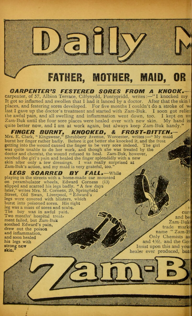 CARPENTER’S FESTERED SORES FROM A KNOCK.— carpenter, of 57, Albion Terrace, Cilfynvdd, Pontypridd, writes:—“I knocked my It got so inflamed and swollen that I had it lanced by a doctor. After that the skin 1 places, and festering sores developed. For five months I couldn’t do a stroke of w last I gave up the doctor’s treatment and started with Zam-Buk. I soon got relie: the awful pain, and all swelling and inflammation went down, too. I kept on ua Zam-Buk until the four sore places were healed over with new skin. My hand is quite better now, and I am at work again, but always keep Zam-Buk handy.” FINGER BURNT, KNOCKED, & FROST-BITTEN. Mrs. E. Clark, “ Kingswear,” Shrubbery Avenue, Worcester, writes:—“ My maid burnt her finger rather badly. Before it got better she knocked it, and the frost getting into the wound caused the finger to be very sore indeed. The gill was quite unable to do her work, and though she was treated by the doctor and chemist, the wound refused to heal. Zam-Buk, however, soothed the girl’s pain and healed the finger splendidly with a new skin after only a few dressings. I was really surprised at Zam-Buk’s action, and my maid is very grateful, too.” LEGS SCARRED BY FALL.— while playing in the streets with a home-made car mounted on perambulator wheels, Edward Corness (13) slipped and scarred his legs badly. “ A few days later,” writes Mrs. M. Corness, 29, Springfield Street, Old Swan, Liverpool, “ Edward’s legs were covered with blisters, which burst into poisoned sores. His right leg was a mass of sores and scabs. The boy was in awful paid. cur Two months' hospital treat, ment failed, but Zam-Buk soothed Edward’s pain, drew out the poison and inflammation, and soon healed his legs with strong new ■kin,”