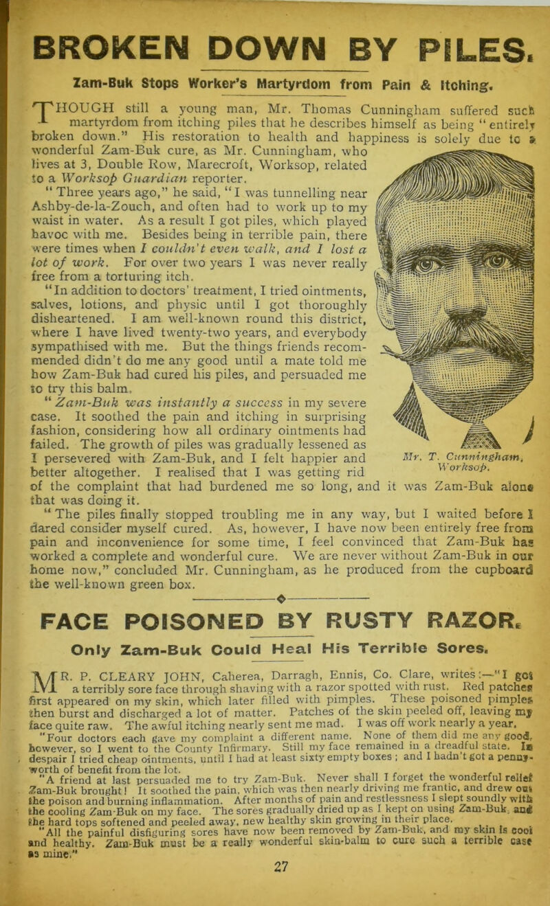 BROKEN DOWN BY PILES. Zam-Buk Stops Worker’s Martyrdom from Pain & Itching. 'THOUGH still a young man, Mr. Thomas Cunningham suffered suck 1 martyrdom from itching piles that he describes himself as being “ entirely broken down.” His restoration to health and happiness is solely due tc s wonderful Zam-Buk cure, as Mr. Cunningham, who lives at 3, Double Row, Marecroft, Worksop, related to a Worksop Guardian reporter. “ Three years ago,” he said, “ I was tunnelling near Ashby-de-la-Zouch, and often had to work up to my waist in water. As a result I got piles, which played havoc with me. Besides being in terrible pain, there were times when I couldn't even walk, and I lost a lot of work. For over two years 1 was never really tree from a torturing itch. “In addition to doctors’ treatment, I tried ointments, salves, lotions, and physic until I got thoroughly disheartened. I am well-known round this district, where I have lived twenty-two years, and everybody sympathised with me. But the things friends recom- mended didn’t do me any good until a mate told me how Zam-Buk had cured his piles, and persuaded me to try this balm. “ Zam-Buk was instantly a success in my severe case. It soothed the pain and itching in surprising fashion, considering how all ordinary ointments had failed. The growth of piles -was gradually lessened as I persevered with Zam-Buk, and I felt happier and better altogether. I realised that I was getting rid of the complaint that had burdened me so long, and it was Zam-Buk alone that was doing it. “ The piles finally stopped troubling me in any way, but I waited before I dared consider myself cured. As, however, I have now been entirely free from pain and inconvenience for some time, I feel convinced that Zam-Buk has worked a complete and wonderful cure. We are never without Zam-Buk in our home now,” concluded Mr. Cunningham, as he produced from the cupboard the well-known green box. T. Cunningham. Worksop. FACE POISONED BY RUSTY RAZOR* Only Zam-Buk Could Heal His Terrible Sores. MR. P. CLEARY JOHN, Caherea, Darragh, Ennis, Co. Clare, writes:—“I gci a terribly sore face through shaving with a razor spotted with rust. Red patches first appeared on my skin, which later filled with pimples. These poisoned pimples then burst and discharged a lot of matter. Patches of the skin peeled off, leaving my face quite raw. The awful itching nearly sent me mad. I was off work nearly a year. Four doctors each gave my complaint a different name. None of them did me any good, however, so I went to the County Infirmary. Still my face remained in a dreadful state. I© despair I tried cheap ointments, until I had at least sixty empty boxes ; and I hadn t got a penny- worth of benefit from the lot. _ _ „ , r 4 . , , _ . A friend at last persuaded me to try Zam-Buk. Never shall I forget the wonderful relief Zam-Buk brought! It soothed the pain, which was then nearly driving me frantic, and drew on* the poison and burning inflammation. After months of pain and restlessness I slept soundly witts the cooling Zam-Buk on my face. The sores gradually dried up as I kept on using Zam-Buk an* Pbe hard tops softened and peeled away, new healthy skin growing in their place. _ All the painful disfiguring sores have now been removed by Zam-Buk, and my skin is cooi and healthy. Zam-Buk must be a really wonderful skin-balm to cure such a terrible case as mine,”