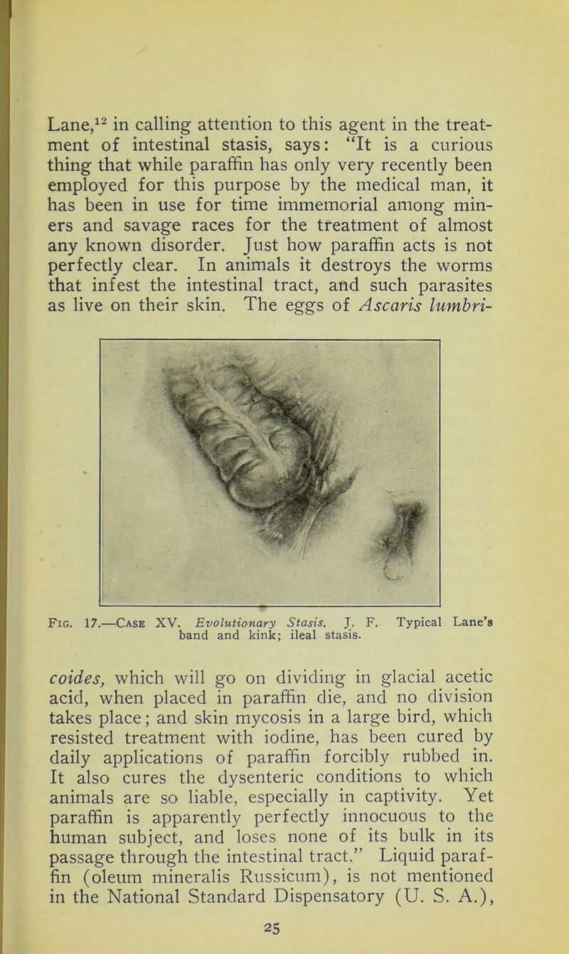 Lane/- in calling attention to this agent in the treat- ment of intestinal stasis, says: “It is a curious thing that while paraffin has only very recently been employed for this purpose by the medical man, it has been in use for time immemorial among min- ers and savage races for the treatment of almost any known disorder. Just how paraffin acts is not perfectly clear. In animals it destroys the worms that infest the intestinal tract, and such parasites as live on their skin. The eggs of Ascaris lumbri- Fig. 17.—Case XV. Evolutionary Stasis. J. F. Typical band and kink; ileal stasis. Lane’s coides, which will go on dividing in glacial acetic acid, when placed in paraffin die, and no division takes place; and skin mycosis in a large bird, which resisted treatment with iodine, has been cured by daily applications of paraffin forcibly rubbed in. It also cures the dysenteric conditions to which animals are so liable, especially in captivity. Yet paraffin is apparently perfectly innocuous to the human subject, and loses none of its bulk in its passage through the intestinal tract.” Liquid paraf- fin (oleum mineralis Russicum), is not mentioned in the National Standard Dispensatory (U. S. A.),