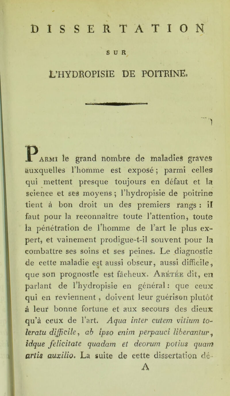 SUR L’HYDROPISIE DE POITRINE, armi le grand nombre de maladies graves auxquelles l’homme est exposé ; parmi celles qui mettent presque toujours en défaut et la science et ses moyens ; l’hydropisie de poitrine tient à bon droit un des premiers rangs : il faut pour la reconnaître toute l’attention, toute la pénétration de l'homme de l’art le plus ex- pert, et vainement prodigue-t-il souvent pour la combattre ses soins et ses peines. Le diagnostic de cette maladie est aussi obscur, aussi difficile, que son prognostîc est fâcheux. Arétée dit, en parlant de l’hydropisie en général : que ceux qui en reviennent , doivent leur guérison plutôt à leur bonne fortune et aux secours des dieux qu’à ceux de l’art. Aqua inter cutem. vitium to- leratu difficile, ab ipso enim perpauci liberantur, idque felicitate quadam et deorum potius quam artis auxilio, La suite de cette dissertation dé ■ A