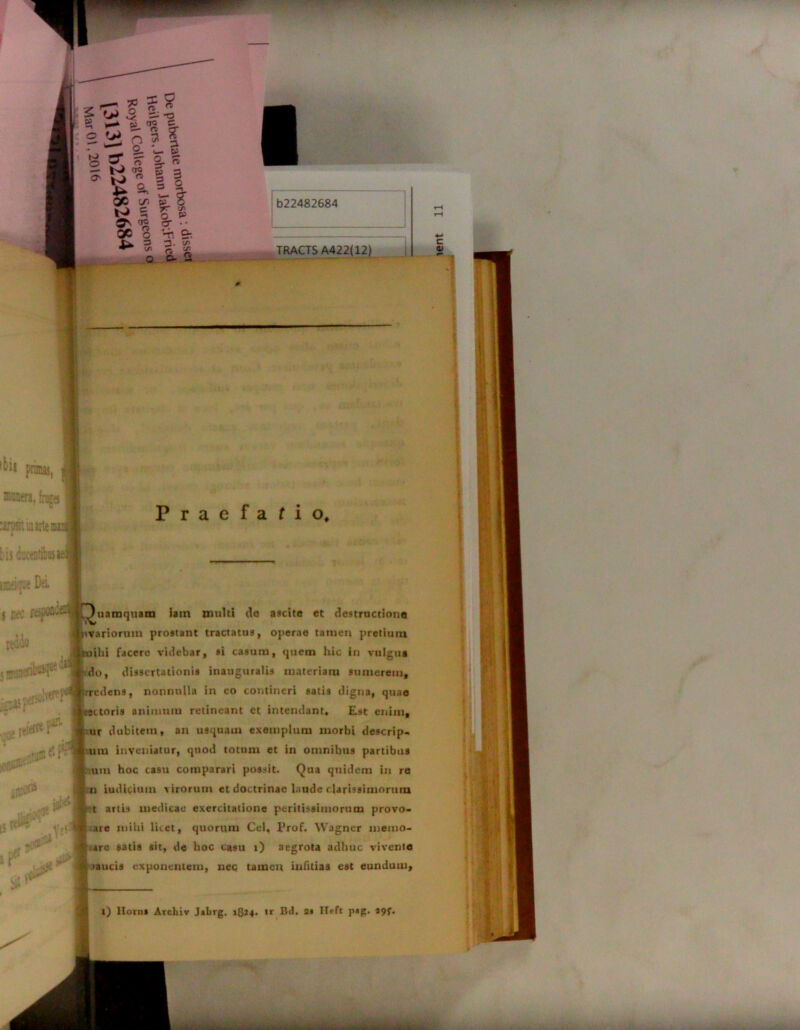 KutTa. fruges mstiaute 2 ■1 Praefafio, iaaf« Dei rjAiyta JWC» i .i r* jefltr ^«Duarnquatn iam multi de ascite et destructione uvariorum prostant tractatus, operae tatuen pretium ilii facere videbar, si casum, quem hic in vulgus do, dissertationis inauguralis materiam sumerem, rcdens, nonnulla in eo contineri satis digna, quae ectoris aninmiu retineant et intendant. Est enim, ur dubitem, an usquam exemplum morbi descrip- mu inveniatur, quod totum et in omnibus partibus ara hoc casu comparari possit. Qua quidem in re u iudicium virorum et doctrinae laude clarissimorum t artis medicae exercitatione parilissimorum provo- are mihi licet, quorum Cei, lJrof. Wagner memo- are satia sit, de hoc casu i) aegrota adhuc vivente aaucis exponentem, nec tamen infitias est eundum. i) Ilorns Archiv J*brg. 1814. 1* Bd. Si Heft p*R. S9f-