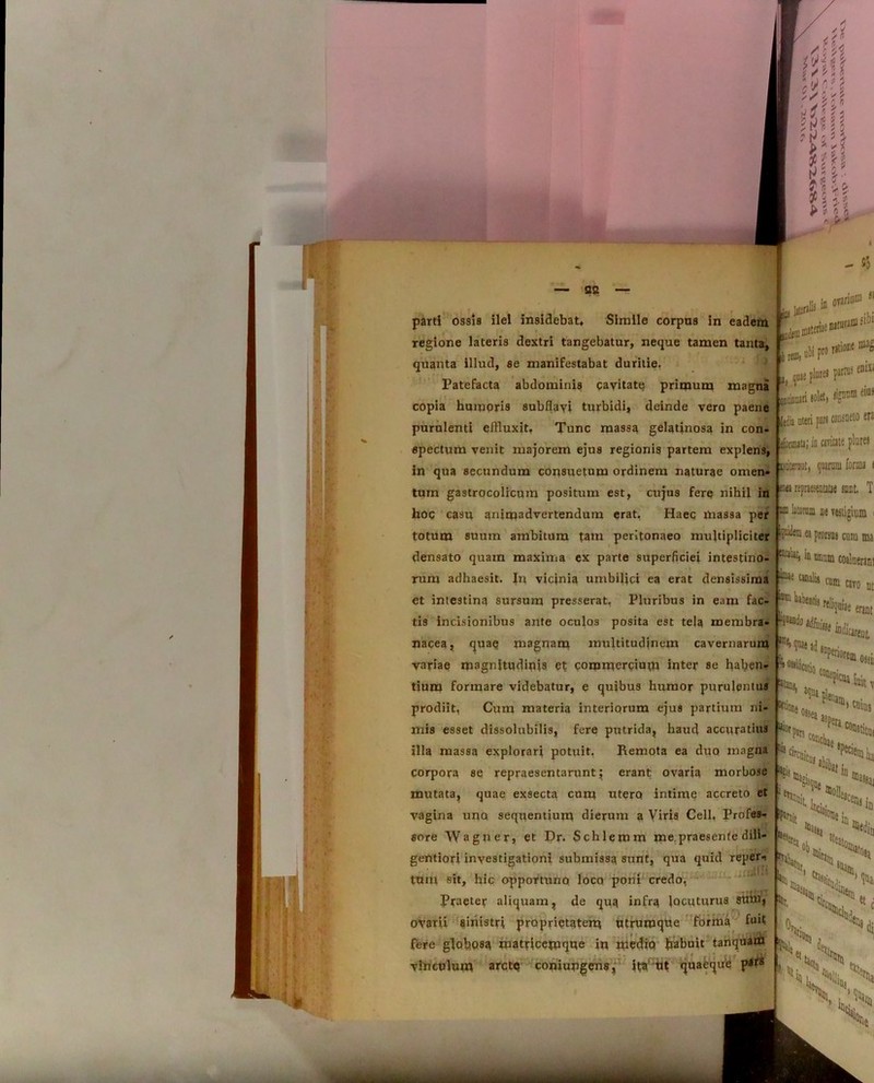 parti ossis ilei insidebat* Simile corpus in eadem regione lateris dextri tangebatur, neque tamen tanta, quanta illud, se manifestabat duritie. Patefacta abdominis cavitate primum magna copia humoris subflavi turbidi, deinde vero paene purulenti elHuxit, Tunc massa gelatinosa in con- spectum venit majorem ejus regionis partem explens, in qua secundum consuetum ordinem naturae omen- tum gastrocolicum positum est, cujus fere nihil in hoc casu animadvertendum erat. Haec massa per totum suum ambitura tam peritonaeo multipliciter densato quam maxima ex parte superficiei intestino- rum adhaesit. In vicinia umbilici ea erat densissima et intestina sursum presserat, Pluribus in eam fac- tis incisionibus ante oculos posita est tela membra- nacea, quae magnam multitudinem cavernarum variae magnitudinis et commercium inter se haben* tium formare videbatur, e quibus humor purulentus prodiit, Cum materia interiorum ejus partium ni- mis esset dissolubilis, fere putrida, haud accuratius illa massa explorari potuit. Remota ea duo magna corpora se repraesentarunt; erant ovaria morbose mutata, quae exsecta cum utero intime accreto et vagina uno sequentium dierum a Viris Cell. Profes- sore Wagner, et Dr. Schlemm me.praesente dili- ... gentiori investigationi submissa sunt, qua quid reper* rui - 50 cituram fib* IltiODC J( gpis plure» partus enixi 0Bihm soM>D®eius Itdia uteri par» MMQeto era eformitj; io «viate plure» titeniut, quarum forau ( wa repraesentatae snut. T mn latorum k vestigium ea prorsus cura ma ia unum coaluerant kii ** caro st |P kalxutis 1:;. *0r. tum sit, hic opportuno loco poni credo, Praeter aliquam, de qua infra locuturus stain, ovarii sinistri proprietatem utruroque forma fuit Wfji fere glohpsa matticemqne in medio habuit tanquam ^ vinculum arcte coniungens, ita ut quaeque p«s 1 wliqaiae erant i:: OSSI! C0^aluiu W' ote ossea Cii aspera > cuius c°ncL , ■'‘'i» »*:que 'N “ N ,i 1,1 ^iti kn> s, % h et % Nk.% ’ in,