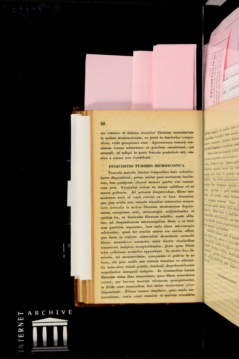 • i 0 u: A R C H I V E UJ i sto externo ct interno transitus fibrarum inuscularimn in molem steatomatosam, ex parte in fasciculos compo- sitam, valde perspicuus erat. Aponeuroses tumoris ter- minum versus adductores et gracilem constituunt, qui musculi, ut reliqui in parte femoris posteriore siti, om- nino a norma non recedebant. DISQUISITIO TUMORIS MICROSCOPICA. Tumoris materia duobus temporibus huic submitte- batur, disquisitioni, primo statim post sectionem institu- tam, tum postquam- aliquot menses spiritu vini conser- vata erat. Constabat autem ex massa solidiore et ex massa pultacea. Ad primam disquirendam, fibrae mu- sculorum recti et vasti externi ex eo loco desumtae, quo jam oculis non armatis transitus substantiae muscu- laris normalis in molem fibrosam steatomatose degene- ratam conspicuus erat, microscopio subjiciebantur et quidem ita, ut fasciculus fibrarum subtilis, caute abla- tus, ad disquisitionem microscopicam fibris a se invi- cem paulatim separatus, luce satis clara microscopio subderetur, quod ter centies omnes res auctas offert, quo facto in regione substantiae muscularis normalis fibrae musculares normales striis liberis regularibus transversis insignes conspiciebantur, juxta quas fibrae telae cellulosae normales apparebant. In medio hoc fa- sciculo, uti memoravimus, praeparato et quidem in eo loco, ubi jam oculis non armatis transitus ex substan- tia musculari videri potuit, fasciculi deprehendebantur magnitudine inaequali insignes. In crassioribus harum fibrarum striae illae transversae, quae fibras musculares notant, per brevem tractum etiamnum percipiebantur, in fibris vero tenuioribus hac striae transversae plane disparebant. Fibrae tenues simplices, quas modo me- moravimus, varia erant crassitia ct-quidem- c assidem liMlunii 'IMI rMiniia iMwrl! mm iiiiniiiiiiiirifii stgm mip iiiwin M IM mi