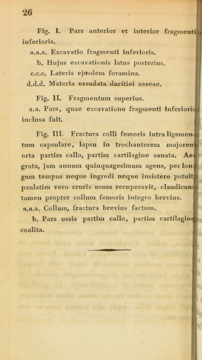 Flg. I. Pars anterior et interior fragraentill inferioris. a.a.a. Excavatio fragmenti inferioris. b. Hujus excavationis latus posterius, c.c.c. Lateris ejusdem foramina, d.d.d. Materia exsudata duritiei osseae. Fig. II. Fragmentum superius, a.a. Pars, quae excavatione fragmenti inferioris! inclusa fuit. | Fig. III. Fractura colli femoris intra ligamen-lu tum capsulare, lapsu in trochanterem majoreirlr orta partim callo, partira cartilagine sanata. Ae-k grota, jam annum quinquagesimum agens, per lon-jlfl] gum tempus neque ingredi neque insistere potuitjh paulatim vero cruris usura recuperavit, claudicamjpi tamen propter collum femoris integro brevius, a.a.a. Collum, fractura brevius factum. BfO b. Pars ossis partim callo, partim cartilagimli coalita.