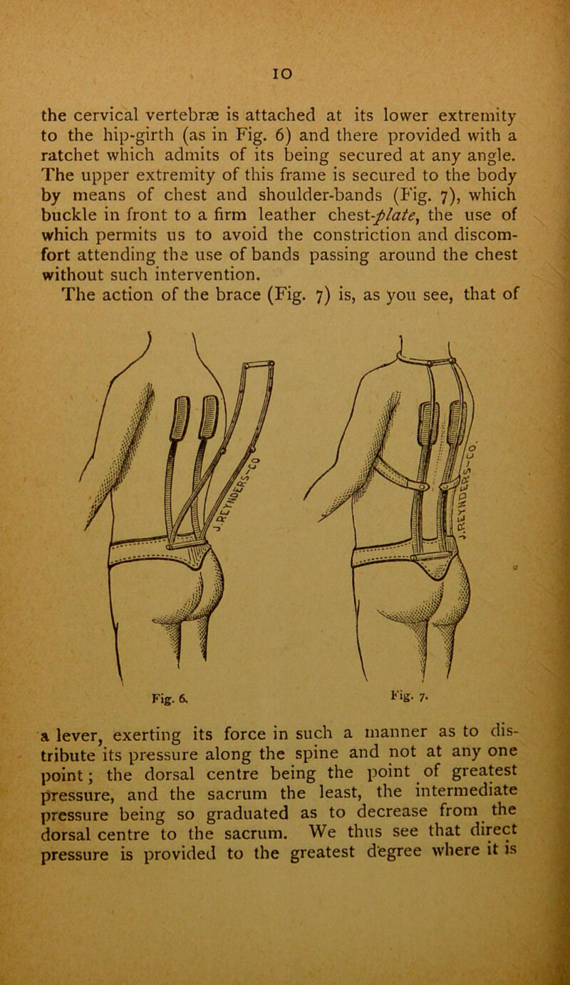 IO the cervical vertebrae is attached at its lower extremity to the hip-girth (as in Fig. 6) and there provided with a ratchet which admits of its being secured at any angle. The upper extremity of this frame is secured to the body by means of chest and shoulder-bands (Fig. 7), which buckle in front to a firm leather chest -plate, the use of which permits us to avoid the constriction and discom- fort attending the use of bands passing around the chest without such intervention. The action of the brace (Fig. 7) is, as you see, that of a lever, exerting its force in such a manner as to dis- tribute its pressure along the spine and not at any one point; the dorsal centre being the point of greatest pressure, and the sacrum the least, the intermediate pressure being so graduated as to decrease from the dorsal centre to the sacrum. We thus see that direct pressure is provided to the greatest degree where it is