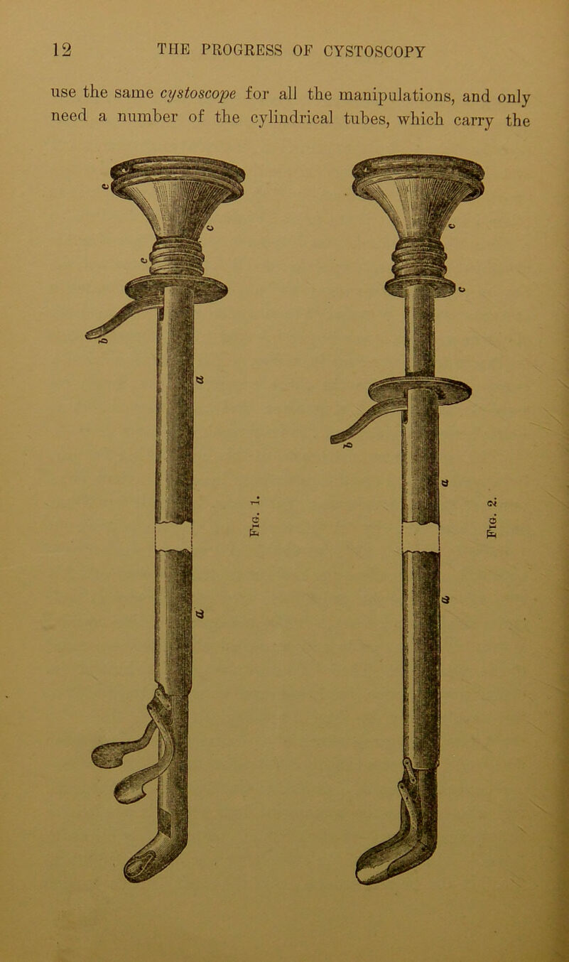 use the same cystoscope for all the manipulations, and only need a number of the cylindrical tubes, which carry the