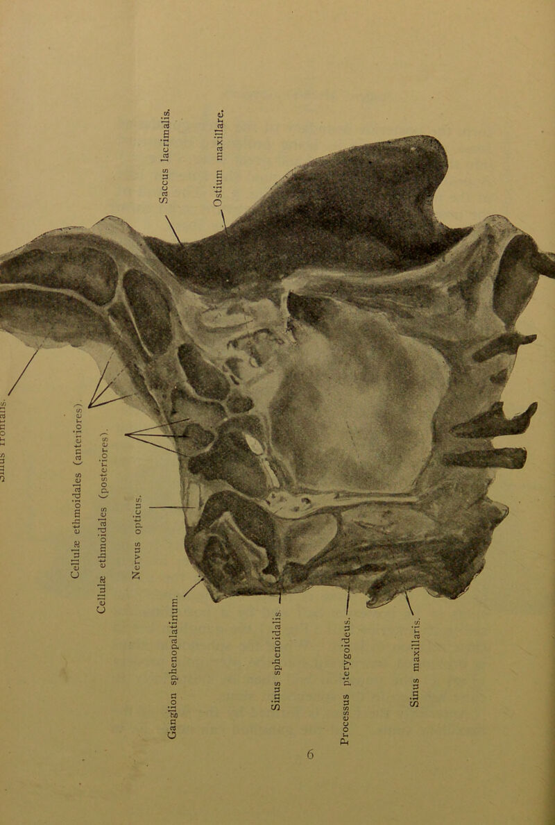 Cellulae etlimoidales (posteriores).