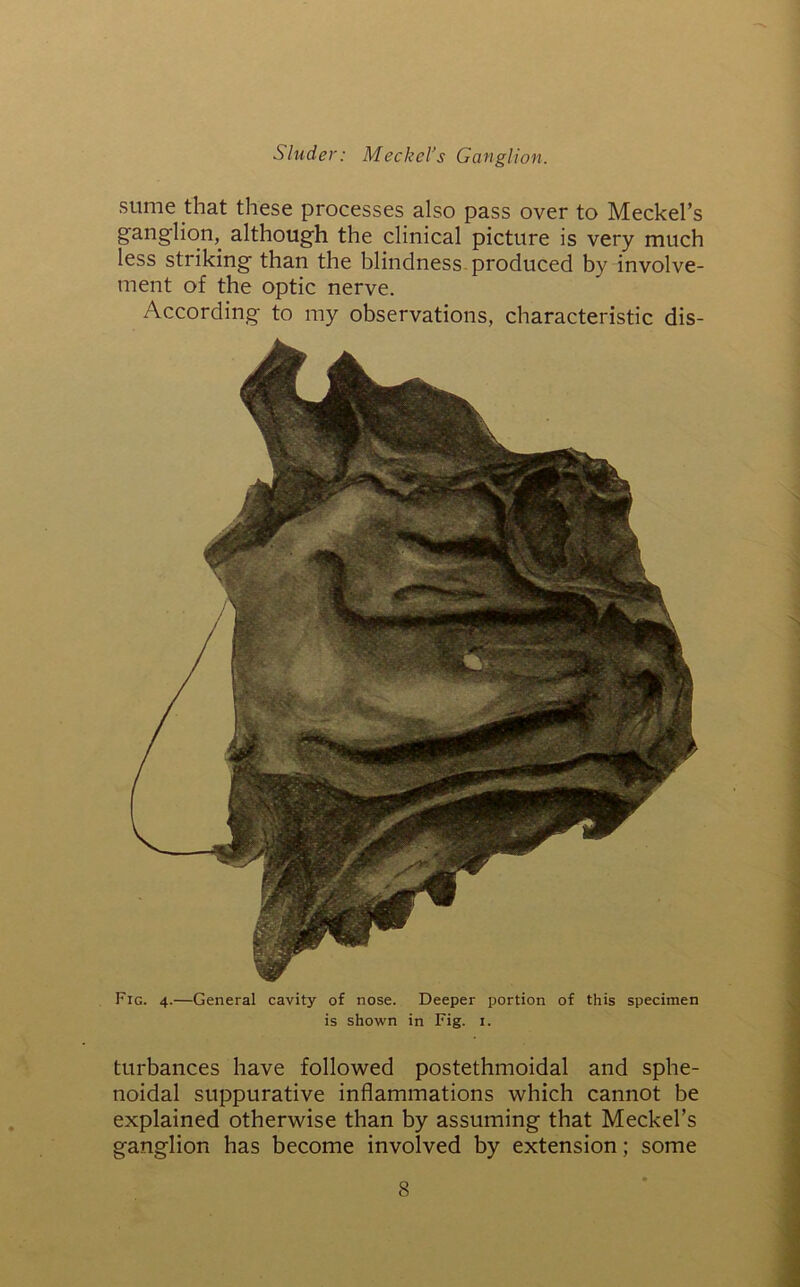 sume that these processes also pass over to Meckel’s ganglion, although the clinical picture is very much less striking than the blindness produced by involve- ment of the optic nerve. According to my observations, characteristic dis- Fig. 4.—General cavity of nose. Deeper portion of this specimen is shown in Fig. 1. turbances have followed postethmoidal and sphe- noidal suppurative inflammations which cannot be explained otherwise than by assuming that Meckel’s ganglion has become involved by extension; some