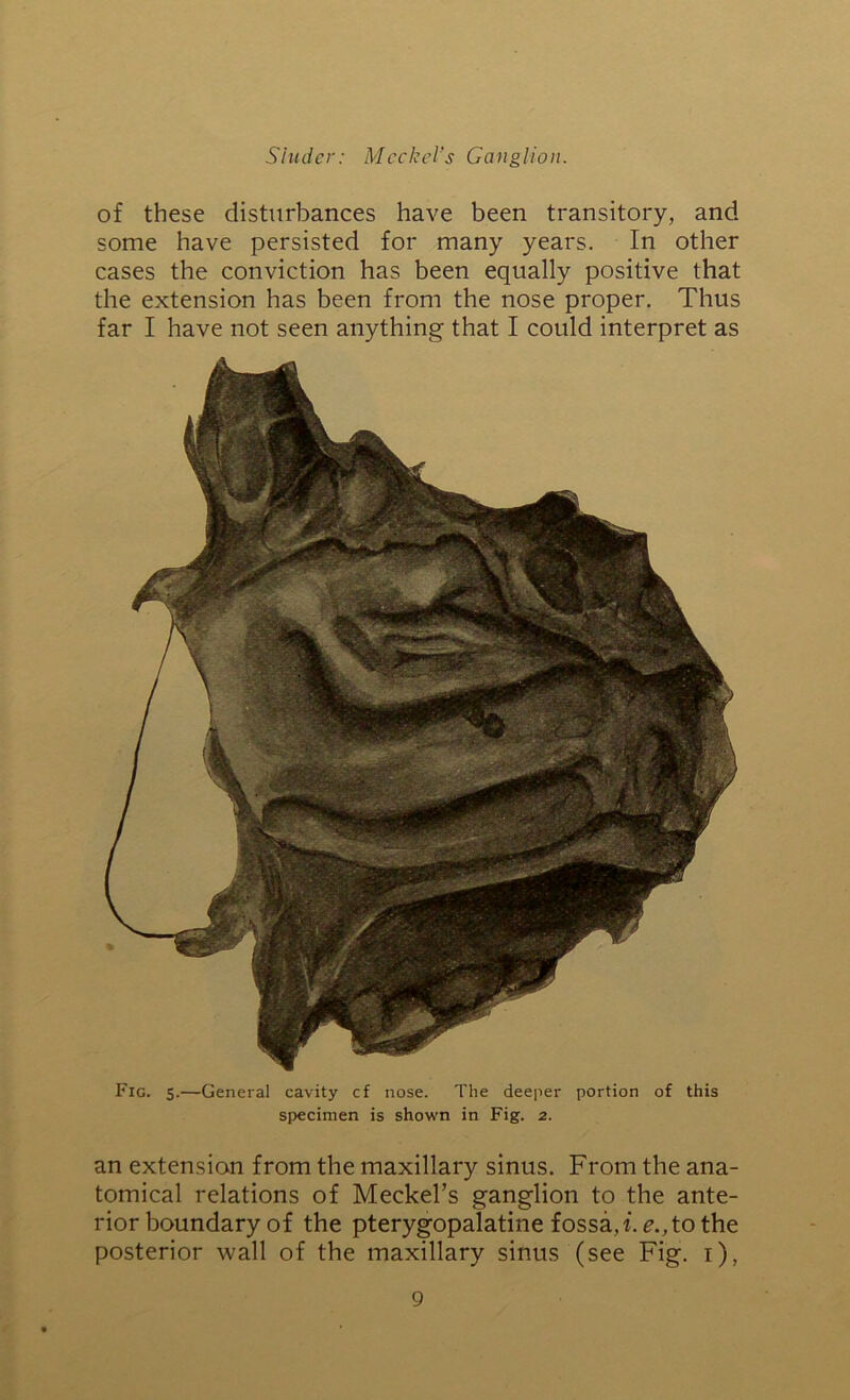 of these disturbances have been transitory, and some have persisted for many years. In other cases the conviction has been equally positive that the extension has been from the nose proper. Thus far I have not seen anything that I could interpret as Fig. 5.—General cavity cf nose. The deeper portion of this specimen is shown in Fig. 2. an extension from the maxillary sinus. From the ana- tomical relations of Meckel’s ganglion to the ante- rior boundary of the pterygopalatine fossa,!, e.,to the posterior wall of the maxillary sinus (see Fig. i),