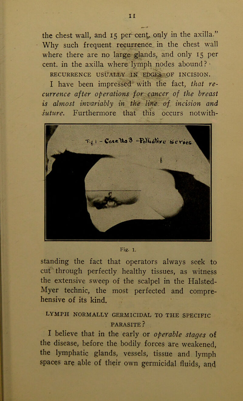 the chest wall, and 15 per cent, only in the axilla.” Why such frequent recurrence in the chest wall where there are no large glands, and only 15 per cent, in the axilla where lymph nodes abound ? RECURRENCE USUALLY IN EDGES OF INCISION. I have been impressed with the fact, that re- currence after operations for cancer of the breast is almost invariably in the line of incision and suture. Furthermore that this occurs notwith- Fig. 1. standing the fact that operators always seek to cut through perfectly healthy tissues, as witness the extensive sweep of the scalpel in the Halsted- Myer technic, the most perfected and compre- hensive of its kind. lymph normally germicidal to the specific PARASITE ? I believe that in the early or operable stages of the disease, before the bodily forces are weakened, the lymphatic glands, vessels, tissue and lymph spaces are ^ble of their own germicidal fluids, and