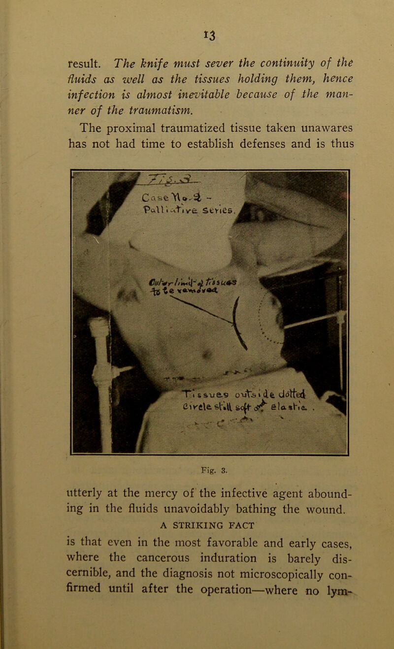 *3 result. The knife must sever the continuity of the fluids as well as the tissues holding them, hence infection is almost inevitable because of the man- ner of the traumatism. The proximal traumatized tissue taken unawares has not had time to establish defenses and is thus Fig. 3. utterly at the mercy of the infective agent abound- ing in the fluids unavoidably bathing the wound. A STRIKING FACT is that even in the most favorable and early cases, where the cancerous induration is barely dis- cernible, and the diagnosis not microscopically con- firmed until after the operation—where no lym-