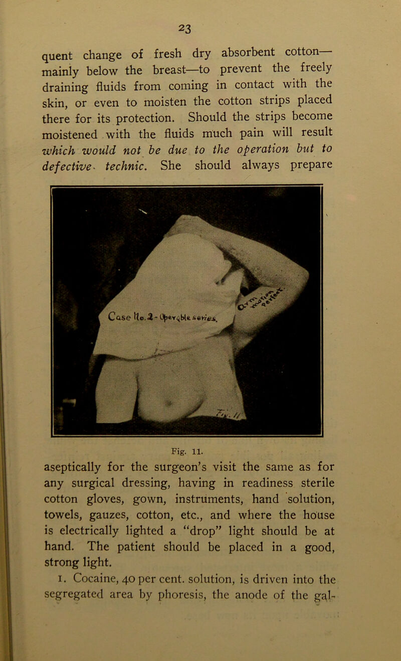 quent change of fresh dry absorbent cotton mainly below the breast—to prevent the freely draining fluids from coming in contact with the skin, or even to moisten the cotton strips placed there for its protection. Should the strips become moistened with the fluids much pain will result which would not be due to the operation but to defective• technic. She should always prepare Fig. 11. aseptically for the surgeon’s visit the same as for any surgical dressing, having in readiness sterile cotton gloves, gown, instruments, hand solution, towels, gauzes, cotton, etc., and where the house is electrically lighted a “drop” light should be at hand. The patient should be placed in a good, strong light. i. Cocaine, 40 per cent, solution, is driven into the segregated area by phoresis, the anode of the gal-