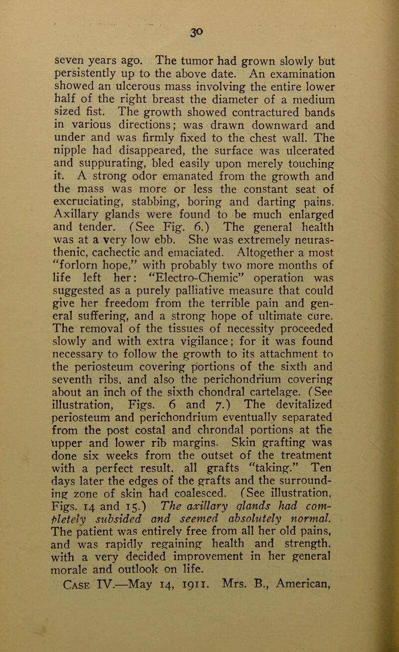 seven years ago. The tumor had grown slowly but persistently up to the above date. An examination showed an ulcerous mass involving the entire lower half of the right breast the diameter of a medium sized fist. The growth showed contractured bands in various directions; was drawn downward and under and was firmly fixed to the chest wall. The nipple had disappeared, the surface was ulcerated and suppurating, bled easily upon merely touching it. A strong odor emanated from the growth and the mass was more or less the constant seat of excruciating, stabbing, boring and darting pains. Axillary glands were found to be much enlarged and tender. (See Fig. 6.) The general health was at a very low ebb. She was extremely neuras- thenic, cachectic and emaciated. Altogether a most “forlorn hope,” with probably two more months of life left her: “Electro-Chemic” operation was suggested as a purely palliative measure that could give her freedom from the terrible pain and gen- eral suffering, and a strong hope of ultimate Cure. The removal of the tissues of necessity proceeded slowly and with extra vigilance; for it was found necessary to follow the growth to its attachment to the periosteum covering portions of the sixth and seventh ribs, and also the perichondrium covering about an inch of the sixth chondral cartelage. (See illustration, Figs. 6 and 7.) The devitalized periosteum and perichondrium eventually separated from the post costal and chrondal portions at the upper and lower rib margins. Skin grafting was done six weeks from the outset of the treatment with a perfect result, all grafts “taking.” Ten days later the edges of the grafts and the surround- ing zone of skin had coalesced. (See illustration. Figs. 14 and 15.) The axillary qlands had com- pletely subsided and seemed absolutely normal. The patient was entirely free from all her old pains, and was rapidly regaining health and strength, with a very decided improvement in her general morale and outlook on life. Case IV.—May 14, 1911. Mrs. B., American,