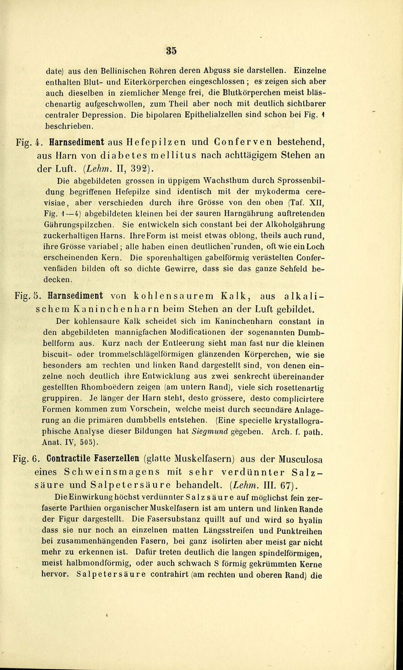 date) aus den Bellinischen Röhren deren Abguss sie darstellen. Einzelne enthalten Blut- und Eiterkörpereben eingeschlossen ; es zeigen sich aber auch dieselben in ziemlicher Menge frei, die Blutkörperchen meist bläs- chenartig aufgeschwollen, zum Theil aber noch mit deutlich sichtbarer centraler Depression. Die bipolaren Epithelialzellen sind schon bei Fig. 1 beschrieben. Fig. 4. Harnsediment aus Hefepilzen und Conferven bestehend, aus Harn von diabetes mellitus nach achttägigem Stehen an der Luft. (Lehm. II, 392). Die abgebildeten grossen in üppigem Wachsthum durch Sprossenbil- dung begriffenen Hefepilze sind identisch mit der mykoderma cere- visiae, aber verschieden durch ihre Grösse von den oben (Taf. XII, Fig. 1—4) abgebildeten kleinen bei der sauren Harngährung auftretenden Gährungspilzchen. Sie entwickeln sich constant bei der Alkoholgährung zuckerhaltigen Harns. Ihre Form ist meist etwas oblong, theils auch rund, ihre Grösse variabel; alle haben einen deutlichenrunden, oft wie ein Loch erscheinenden Kern. Die sporenhaltigen gabelförmig verästelten Confer- venfäden bilden oft so dichte Gewirre, dass sie das ganze Sehfeld be- decken. Fig. 5. Harnsediment von kohlensaurem Kalk, aus alkali- schem Kaninchen harn beim Stehen an der Luft gebildet. Der kohlensaure Kalk scheidet sich im Kaninchenharn constant in den abgebildeten mannigfachen Modifloationen der sogenannten Dumb- bellform aus. Kurz nach der Entleerung sieht man fast nur die kleinen biscuit- oder trommelschlägeiförmigen glänzenden Körperchen, wie sie besonders am rechten und linken Rand dargestellt sind, von denen ein- zelne noch deutlich ihre Entwicklung aus zwei senkrecht übereinander gestellten Rhomboedern zeigen (am untern Rand), viele sich rosettenartig gruppiren. Je länger der Harn steht, desto grössere, desto complicirtere Formen kommen zum Vorschein, welche meist durch secundäre Anlage- rung an die primären dumbbells entstehen. (Eine specielle krystallogra- phische Analyse dieser Bildungen hat Siegmund gegeben. Arch. f. path. Anat. IV, 503). Fig. 6. Contractile Faserzellen (glatte Muskelfasern) aus der Musculosa eines Schweinsmagens mit sehr verdünnter Salz- säure und Salpetersäure behandelt. [Lehm. III. 67). Die Einwirkung höchst verdünnter Sa 1 z s äur e auf möglichst fein zer- faserte Parthien organischer Muskelfasern ist am untern und linken Rande der Figur dargestellt. Die Fasersubstanz quillt auf und wird so hyalin dass sie nur noch an einzelnen matten Längsstreifen und Punktreihen bei zusammenhängenden Fasern, bei ganz isolirten aber meist gar nicht mehr zu erkennen ist. Dafür treten deutlich die langen spindelförmigen, meist halbmondförmig, oder auch schwach S förmig gekrümmten Kerne hervor. Salpetersäure contrahirt (am rechten und oberen Rand) die