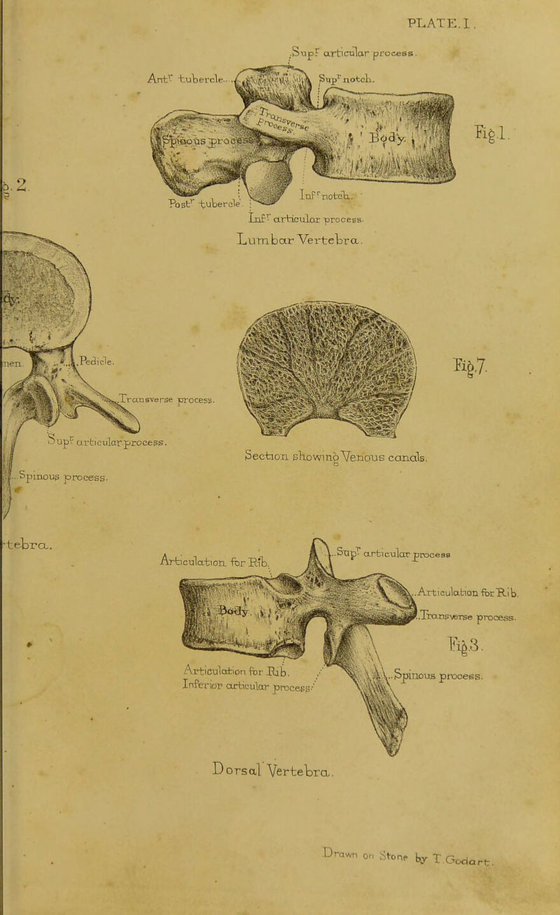 2. ..SiapF articular process. InF^'Tioteli. Post'' tubercle. ; TnfT articular process. Lumbar Vertetra. ansverse pi-ocess. Sup? urticular process. Fig.l. Section sliowin^Venous canals. pinoug process. •teb rcL. Articulation, for R't Stlp! articular process Articulation fbr Hib. Inferior articular pi-ocesg.-' Dorsal Vertetra. Arti culation fbr Ri b. .lrans\«Tse process. .ous process. Drawn on StoaP by T Oodart.