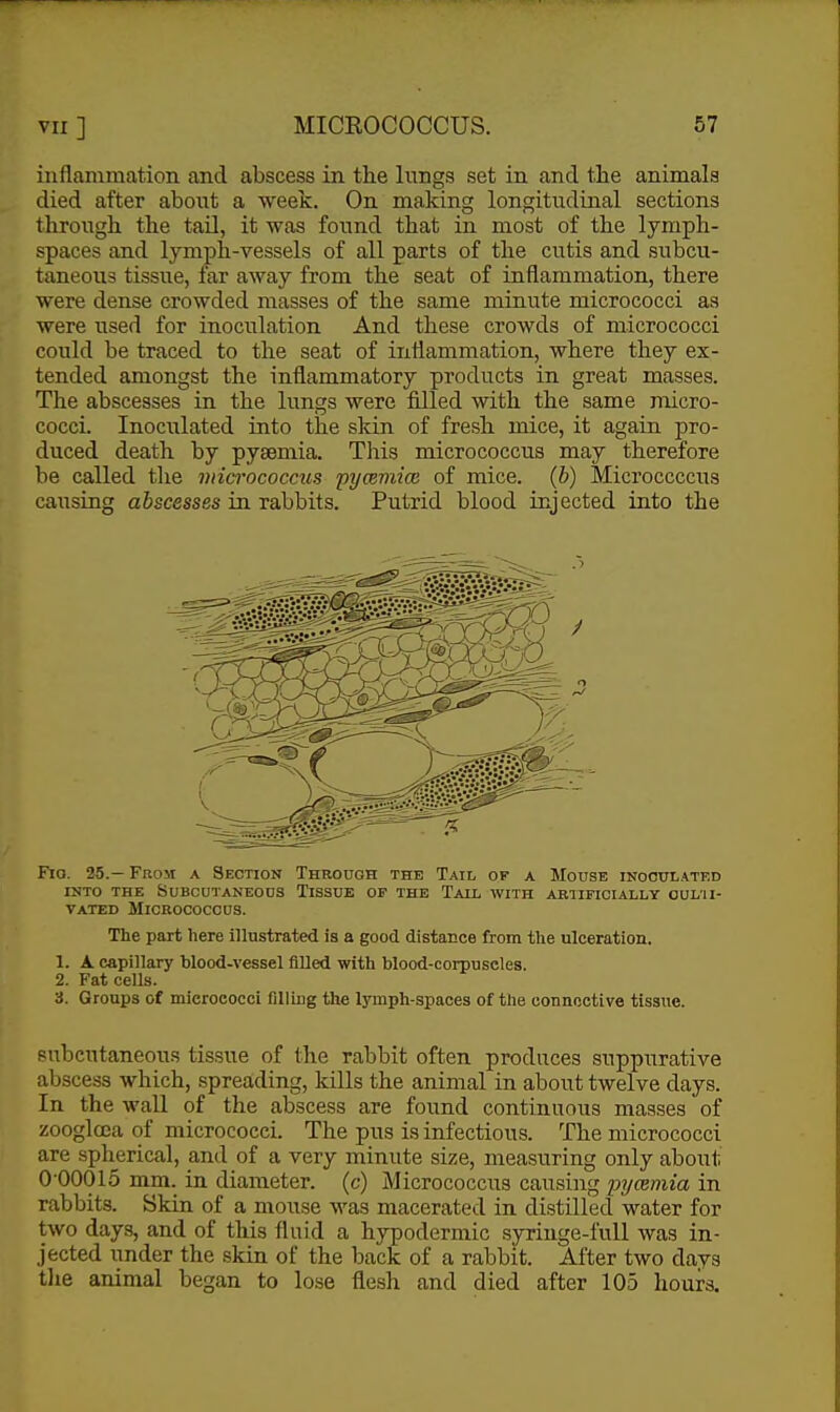 inflammation and abscess in the lungs set in and the animals died after about a week. On making longitudinal sections through the tail, it was found that in most of the lymph- spaces and lymph-vessels of all parts of the cutis and subcu- taneous tissue, far away from the seat of inflammation, there were dense crowded masses of the same minute micrococci as were used for inoculation And these crowds of micrococci could be traced to the seat of inflammation, where they ex- tended amongst the inflammatory products in great masses. The abscesses in the lungs were filled with the same micro- cocci. Inoculated into the skin of fresh mice, it again pro- duced death by pytemia. This micrococcus may therefore be called tlie micrococcus pycemiai of mice, (b) Microccccus causing abscesses in rabbits. Putrid blood injected into the Fio. 25.- From a Section Through the Tail of a Mouse inoculated INTO THE Subcutaneous Tissue of the Tail with aetificially oulii- vated Micrococcus. The part here illustrated is a good distance from the ulceration. 1. A capillary blood-vessel iilled with blood-corpuscles. 2. Fat cells. 3. Groups of mieroeocci filling the lymph-spaces of the connective tissue. subcutaneous tissue of the rabbit often produces suppurative abscess which, spreading, kills the animal in about twelve days. In the wall of the abscess are found continuous masses of zooglcea of micrococci. The pus is infectious. The micrococci are spherical, and of a very minute size, measuring only about 000015 mm. in diameter, (c) Micrococcus causing pycemia in rabbits. Skin of a mouse M'as macerated in distilled water for two days, and of this fluid a hypodermic syringe-full was in- jected under the skin of the back of a rabbit. After two days tlie animal began to lose flesh and died after 105 hours.