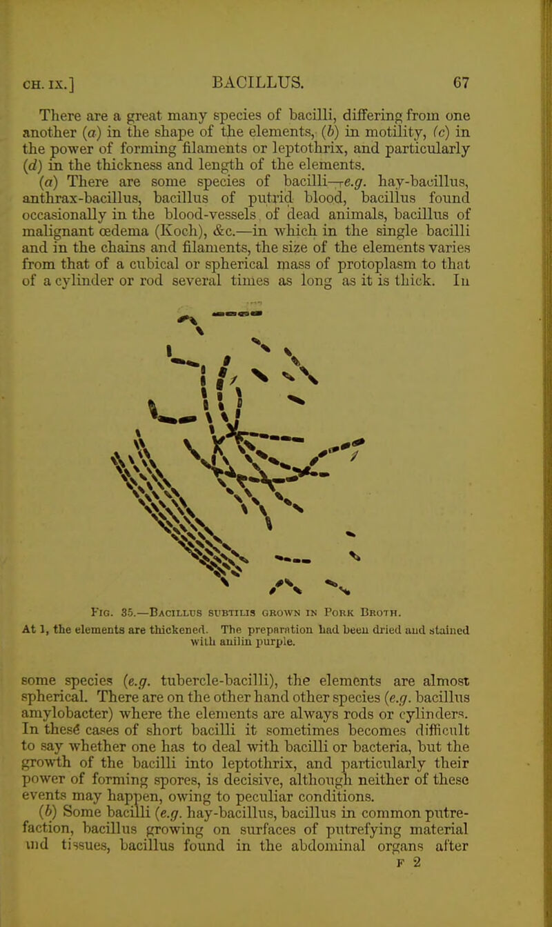 There are a great many species of bacilli, differing from one another (a) in the shape of the elements, (b) in motility, Cc) in the power of forming filaments or leptothrix, and particularly (d) in the thickness and length of the elements. (a) There are some species of bacilli—re.gf. hay-bacillus, anthrax-bacUlus, bacillus of putiicl blood, bacillus found occasionally in the blood-vessels of dead animals, bacillus of malignant oedema (Koch), &c.—in Avhich in the single bacilli and in the chains and filaments, the size of the elements varies from that of a cubical or spherical mass of protoplasm to that of a cylinder or rod several times as long as it is thick. In ^ — \ Fig. 35.—Bacillus subtilis grown in Pork Broth. At 1, the elements are thickenerl. The prepBrntion had been dried aud stained wUh auiliu jjurple. some species (6.17. tubercle-bacilli), the elements are almost spherical. There are on the other hand other species (e.g. bacillus amylobacter) where the elements are always rods or cylinders. In thesS cases of short bacilli it sometimes becomes difficult to say whether one has to deal with bacilli or bacteria, but the growth of the bacilli into leptothrix, and particularly their power of forming spores, is decisive, although neither of these events may happen, owing to peculiar conditions. (b) Some bacilli {e.g. hay-bacillus, bacillus in common putre- faction, bacillus growing on surfaces of putrefying material md tissues, bacillus found in the abdominal organs after F 2