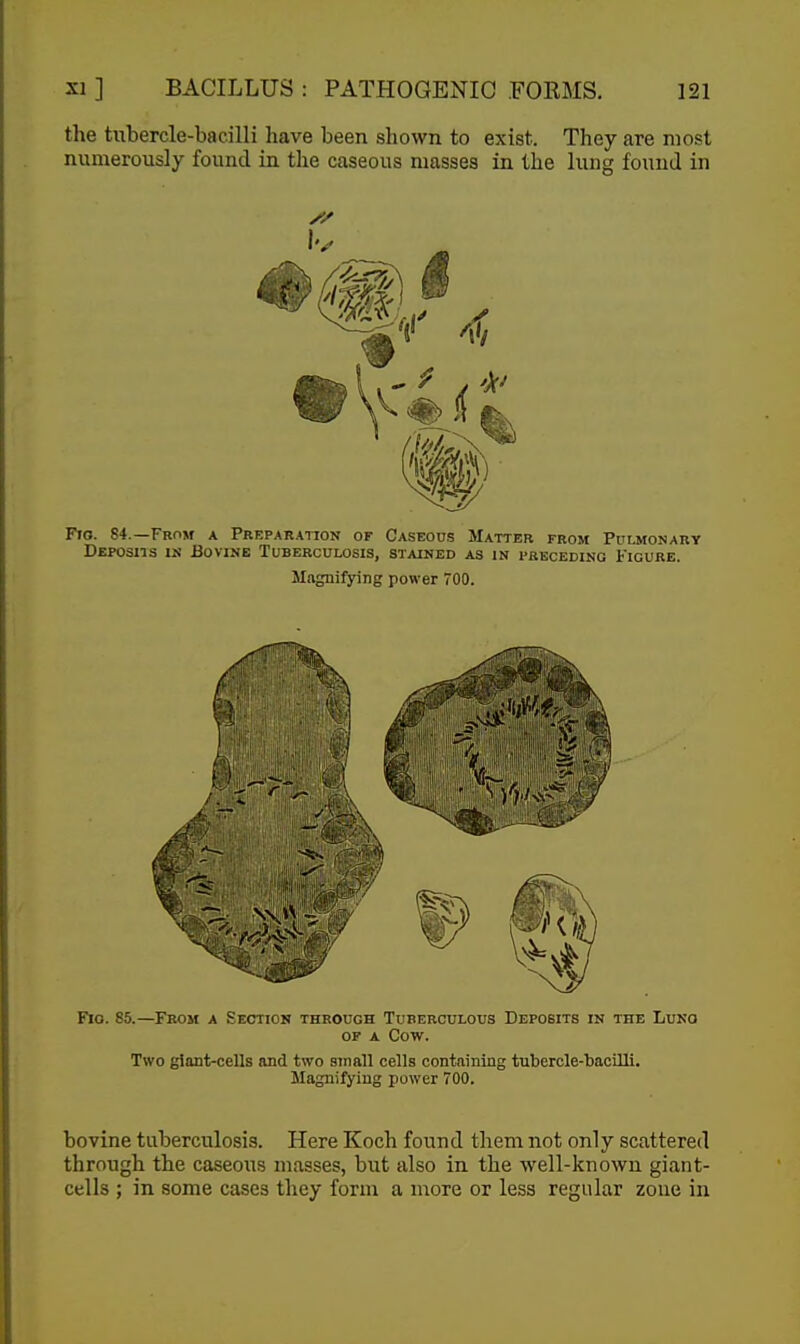 the tubercle-bacilli have been shown to exist. They are most numerously found in the caseous masses in the lung found in Fio. 85.—From a Section through Tuberculous Deposits in the Luno OF A Cow. Two giant-cells and two small cells containing tubercle-bacilli. Magnifying power 700. bovine tuberculosis. Here Koch found them not only scattered through the caseous masses, but also in the well-known giant- cells ; in some cases they form a more or less regular zone in