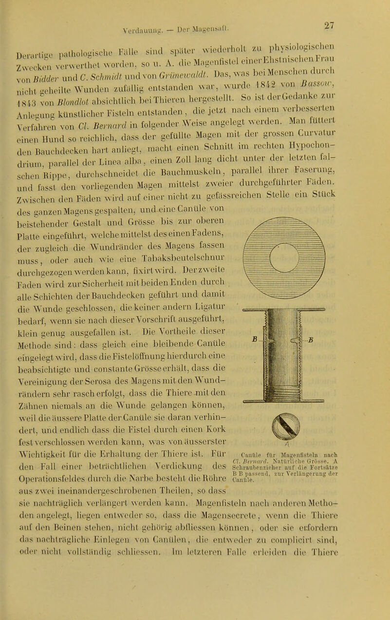 Derarli.'e palholo^ische Fälle sind späler wiederholl zu physiolog.s hon l^n u«.-wcHhet .onU-n, so u. A. die Magenlislcl einerEhsln.schenlr.u von Bidäer und C. Schmidt und von Grihmccdät.. Das, ^vns ])ei Menschen durch X;felKMUe Wunden zuialli, on.slanden .ar, wurde -1842 .ou Basso^c, ,1843 Ion Blondlot. ahsiehllich beiThieren hergeslellt. So ist derGedanke zur Anle-ung künstlicher Fisteln entstanden , die jetzt nach einem verbesserlen Verfahre;! von Cl. Bernard in folgender Weise angelegt ^verden. Man füttert einen Hund so reichlich, dass der gefüllte Magen mit der grossen Curyatur den Bauchdecken hart anliegt, macht einen Schnitt im rechten Hypochon- drium parallel der Linea alba, einen Zoll lang dicht unter der letzten fal- schen Rippe, durchschneidet die Bauchmuskeln, parallel ihrer Faserung, und fasst den vorliegenden Magen mittelst zweier durchgeführter Faden. Zwischen den Fäden wird auf einer nicht zu gefässreichen Stelle ein Stuck des ganzen Magens gespalten, und einc Canüle von beistdiender Gestalt und Grösse bis zur oberen Platte eingeführt, welche mittelst des einen Fadens, der zugleich die Wundränder des Magens fassen muss, oder auch wie eine Tabaksbeutelschnur durchgezogen werden kann, fixirtwird. Der zweite Faden\vird zur Sicherheit mit beiden Enden durch alle Schichten der Bauchdecken geführt und damit die Wunde geschlossen, die keiner andern Ligatur bedarf, wenn sie nach dieser Vorschrift ausgeführt, klein genug ausgefallen ist. Die Yoi-lheile dieser Methode sind: dass gleich eine bleibende Canüle eingelegt wird, dass die Fistelöftiumg hierdurch eine beabsichtigte und constante Grösse erhält, dass die Vereinigung der Serosa des Magens mit den Wund- rändern sehr rasch erfolgt, dass die Thiere jnit den Zähnen niemals an die Wunde gelangen können, weil die äussere Platte der Canüle sie daran verhin- dert, und endlich dass die Fistel durch einen Kork fest verschlossen werden kann, was vonäusserster Wichtigkeil für die Erhaltung der Thiere ist. Für den Fall einer beträchtlichen Verdickung des Operationsfeldes durch die Narbe besteht die Röhre aus zwei ineinandergcschrobenen Theilen, sodass sie nachträglich verlängei't werden kann. Magenlisteln nach anderen Metho- den angelegt, liegen entweder so, dass die Magensecrcle, wenn die Thiere auf den Beinen stehen, nicht gehörig abiliessen können, oder sie erfordern das nachträgliche Einlegen von Canülen, die entweder zu complicirl sind, oder nicht vnjjständiLr schliessen. Im letzteren Falle erlcMden die Thiere Canüle für Magpiifisteln nach Cl. Hirnaril. Natürliche Grösse. A SchranbenzieUer auf die Fortsätze B B i)asse!id, zur Verlängerung der Canüle.