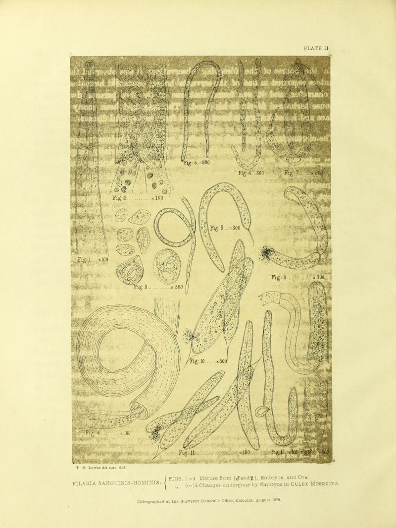 PLATE II T R Lewis ad nat dei I FIGS. 1-4 Mature form r.<?aTid?], Embryos, and Ova FILARIA SANGUINIS-HOMINIS ; I Changes utidergone by Embryos m Culex Mosquito. lithographed at the Surveyor General s Office. Calcutta, AuSusl