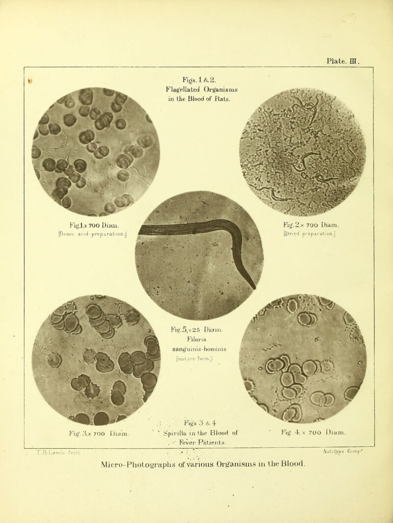 Fig-.3,x 700 Diam.  * S'pirilta in tjrie Blood of ' Fig.^. x 700 IJja m, . ■■ Fever Patjent.s. T.R Lewis fc-il , ■ AulutyjJe Comp Micro-Pholograpli8 of various Org'anisms m the Blood.