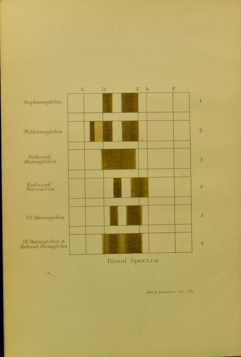 Oxyhcemoglobitv MethcemoqLobirv RedtvcecL /fcento cfiobOiv /ieduced/ Hcetwa.tilth CO -fleemoglobow CO Hcemoglobitv So Reduced Hmrnoc/iobin Blood Spectra, Bale it JkmUUfon,