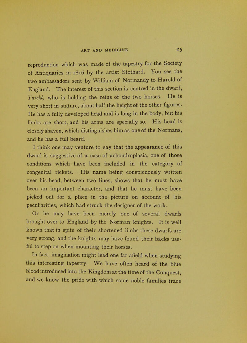 reproduction which was made of the tapestry for the Society of Antiquaries in 1816 by the artist Stothard. You see the two ambassadors sent by William of Normandy to Harold of England. The interest of this section is centred in the dwarf, Tuyold, who is holding the reins of the two horses. He is very short in stature, about half the height of the other figures. He has a fully developed head and is long in the body, but his limbs are short, and his arms are specially so. His head is closely shaven, which distinguishes him as one of the Normans, and he has a full beard. I think one may venture to say that the appearance of this dwarf is suggestive of a case of achondroplasia, one of those conditions which have been included in the category of congenital rickets. His name being conspicuously written over his head, between two lines, shows that he must have been an important character, and that he must have been picked out for a place in the picture on account of his peculiarities, which had struck the designer of the work. Or he may have been merely one of several dwarfs brought over to England by the Norman knights. It is well known that in spite of their shortened limbs these dwarfs are very strong, and the knights may have found their backs use- ful to step on when mounting their horses. In fact, imagination might lead one far afield when studying this interesting tapestry. We have often heard of the blue blood introduced into the Kingdom at the time of the Conquest, and we know the pride with which some noble families trace