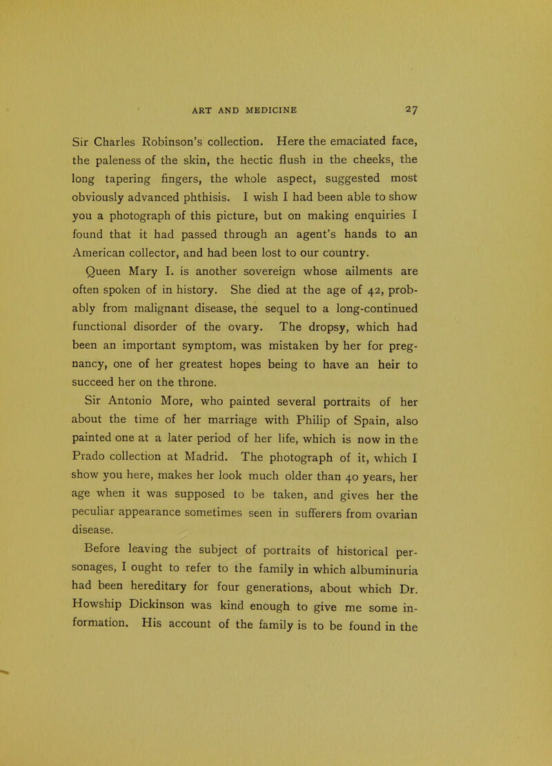 Sir Charles Robinson's collection. Here the emaciated face, the paleness of the skin, the hectic flush in the cheeks, the long tapering fingers, the whole aspect, suggested most obviously advanced phthisis, I wish I had been able to show you a photograph of this picture, but on making enquiries I found that it had passed through an agent's hands to an American collector, and had been lost to our country. Queen Mary I. is another sovereign whose ailments are often spoken of in history. She died at the age of 42, prob- ably from malignant disease, the sequel to a long-continued functional disorder of the ovary. The dropsy, which had been an important symptom, was mistaken by her for preg- nancy, one of her greatest hopes being to have an heir to succeed her on the throne. Sir Antonio More, who painted several portraits of her about the time of her marriage with Philip of Spain, also painted one at a later period of her life, which is now in the Prado collection at Madrid. The photograph of it, which I show you here, makes her look much older than 40 years, her age when it was supposed to be taken, and gives her the peculiar appearance sometimes seen in sufferers from ovarian disease. Before leaving the subject of portraits of historical per- sonages, I ought to refer to the family in which albuminuria had been hereditary for four generations, about which Dr. Howship Dickinson was kind enough to give me some in- formation. His account of the family is to be found in the