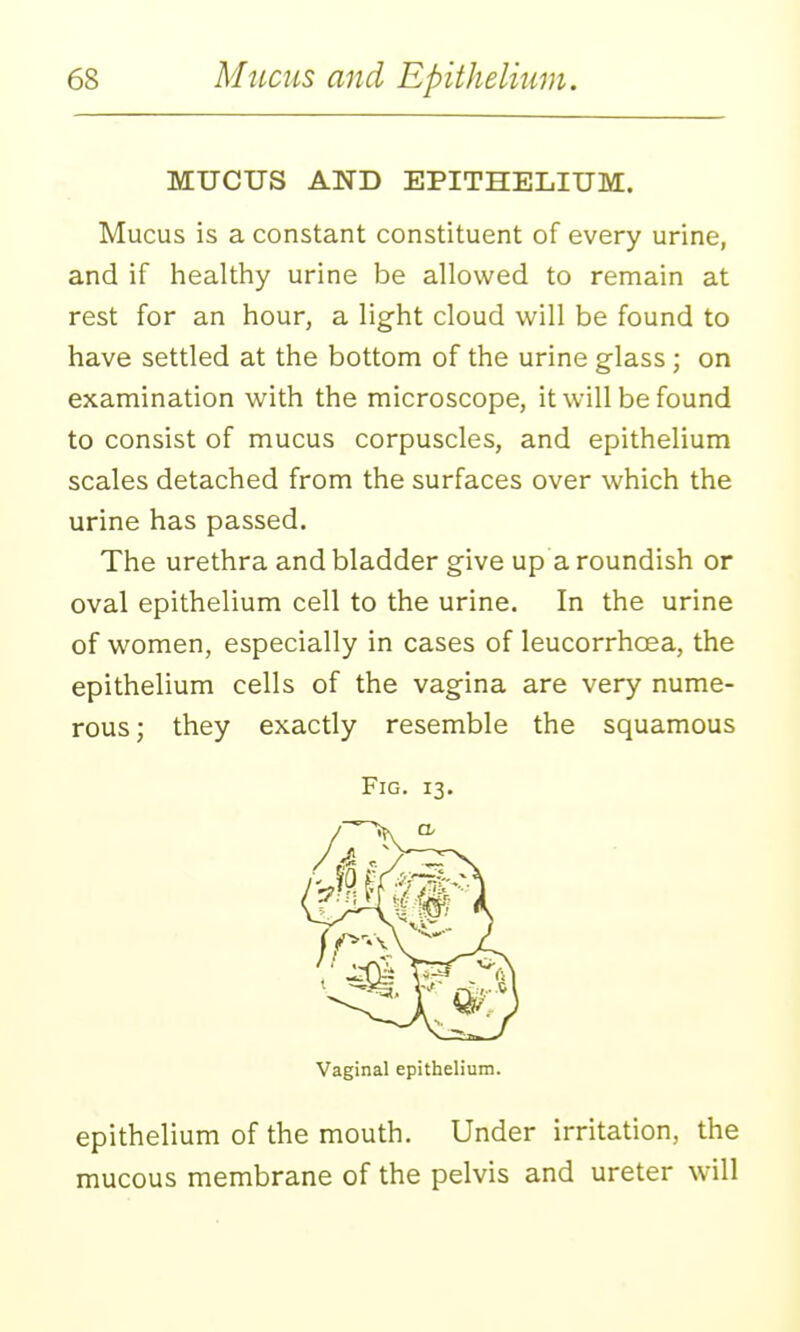 MUCUS AND EPITHELIUM. Mucus is a constant constituent of every urine, and if liealthy urine be allowed to remain at rest for an hour, a light cloud will be found to have settled at the bottom of the urine glass; on examination with the microscope, it will be found to consist of mucus corpuscles, and epithelium scales detached from the surfaces over which the urine has passed. The urethra and bladder give up a roundish or oval epithelium cell to the urine. In the urine of women, especially in cases of leucorrhoea, the epithelium cells of the vagina are very nume- rous; they exactly resemble the squamous epithelium of the mouth. Under irritation, the mucous membrane of the pelvis and ureter will Fig. 13. Vaginal epithelium.
