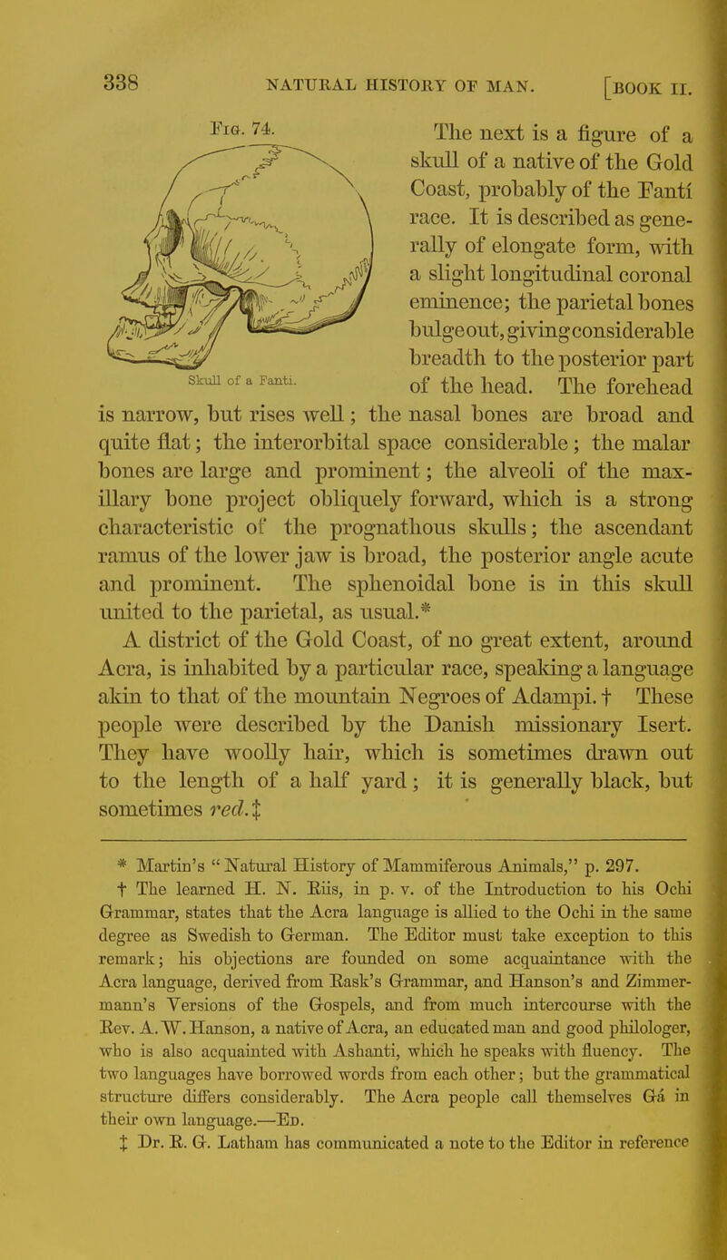 Pig. 74. The next is a figure of a skull of a native of the Gold Coast, probably of the Eanti race. It is described as gene- rally of elongate form, with a slight longitudinal coronal eminence; the parietal bones bulge out, giving considerable breadth to the posterior part of the head. The forehead SkiiU of a Fanti. is narrow, but rises well; the nasal bones are broad and quite flat; the interorbital space considerable; the malar bones are large and prominent; the alveoli of the max- illary bone project obliquely forward, which is a strong characteristic of the prognathous skulls; the ascendant ramus of the lower jaw is broad, the posterior angle acute and prominent. The sphenoidal bone is in this skull united to the parietal, as usual.* A district of the Gold Coast, of no great extent, around Acra, is inhabited by a particular race, spealdng a language akin to that of the mountain Negroes of Adampi. f These people were described by the Danish missionary Isert. They have woolly hair, which is sometimes drawn out to the length of a half yard; it is generally black, but sometimes red.t * Martin's  Natural History of Mammiferous Animals, p. 297. t The learned H. N. Eiis, in p. v. of the Introduction to his Ochi Grammar, states that the Acra language is allied to the Ochi in the same degree as Swedish to Grerman. The Editor must talce exception to this remark; his objections are founded on some acg^uaiatance with the Acra language, derived from East's Grrammar, and Hanson's and Zimmer- mann's Versions of the Gospels, and from much intercourse with the Eev. A.W.Hanson, a native of Acra, an educated man and good philologer, who is also acquainted with Ashanti, which he speaks with fluency. The two languages have borrowed words from each other; but the grammatical structure differs considerably. The Acra people call themselves Ga in their own language.—En. J Dr. E. G. Latham has communicated a note to the Editor in reference
