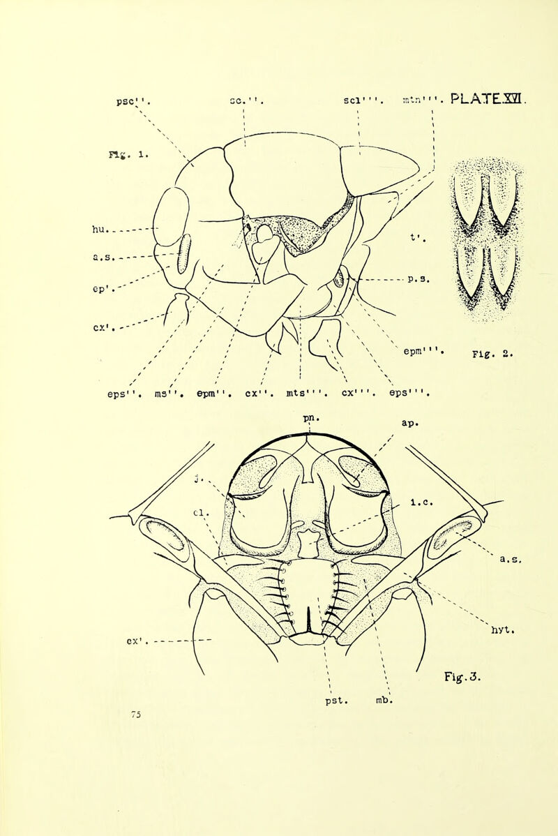 75