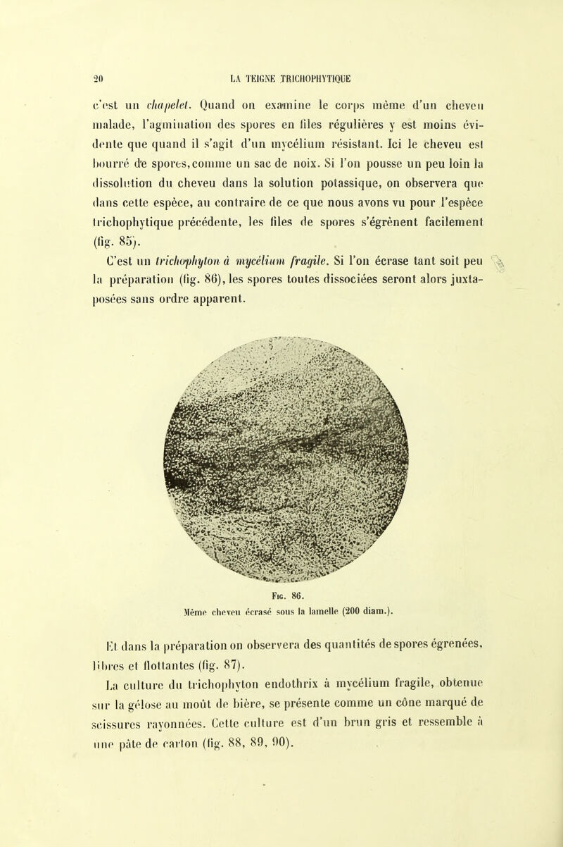 c'est un cliapeJet. Quand on examine le corps même d'un cheveu malade, l'agmination des spores en iiles régulières y est moins évi- dente que quand il s'agit d'un mycélium résistant. Ici le cheveu esl hourré d'e spores, comme un sac de noix. Si l'on pousse un peu loin la dissoliition du cheveu dans la solution potassique, on observera que dans cette espèce, au contraire de ce que nous avons vu pour l'espèce trichophytique précédente, les files de spores s'égrènent facilement (fig. 85). C'est un tricliO'phyton à mycélium fragile. Si l'on écrase tant soit peu J| la préparation (lig. 86), les spores toutes dissociées seront alors juxta- posées sans ordre apparent. Fig. 86. Même cheveu écrasé sous la lamelle (200 diam.). l'.t dans la préparation on observera des quantités despores égrenées, libres et llottantes (fig. 87). La culture du trichophyton endothrix à mycélium fragile, obtenue sur la gélose au moût de bière, se présente comme un cône marqué de scissures rayonnées. Cette culture est d'un brun gris et ressemble à line pâte de carton (fig. 88, 89, 00).