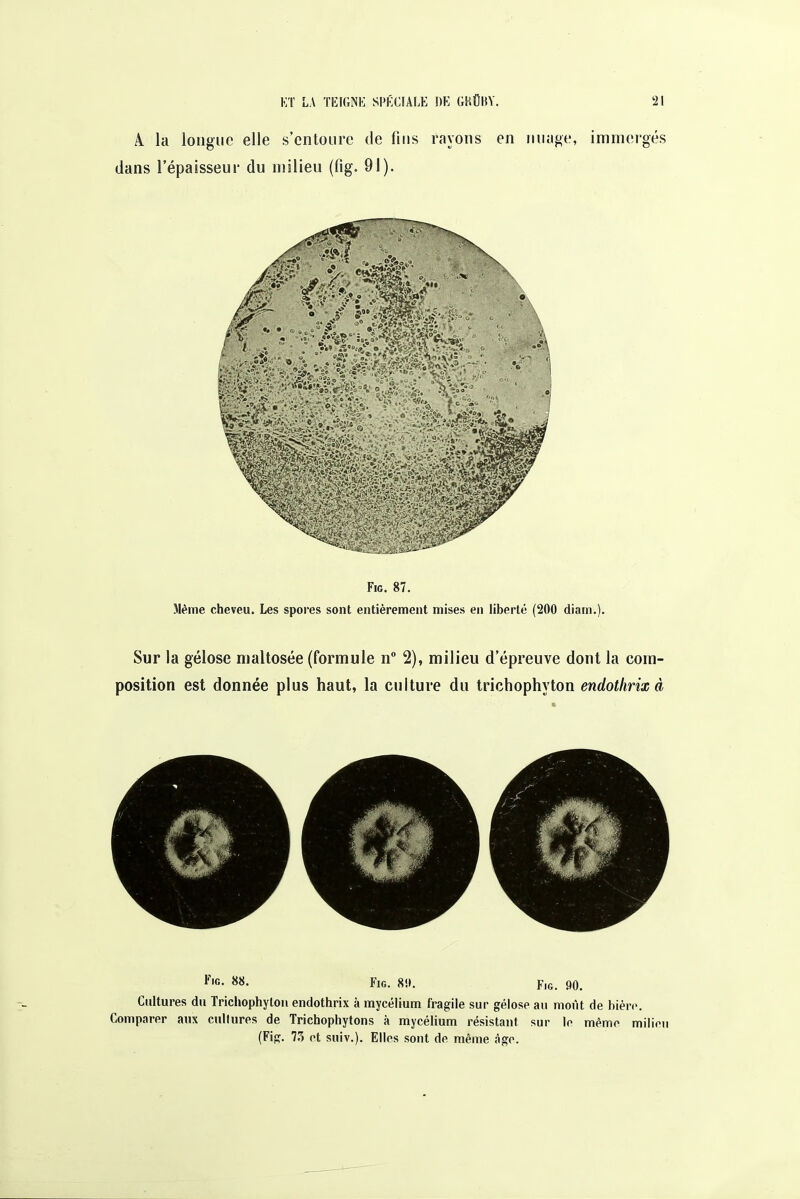 A. la longue elle s'entoure de fins rayons en nuage, immergés dans l'épaisseur du milieu (fig. 91). Fie. 87. Même cheveu. Les spores sont entièrement mises en liberté (200 diam.). Sur la gélose nialtosée (formule n° 2), milieu d'épreuve dont la com- position est donnée plus haut, la culture du trichophyton endotlirix à l'ic. 88. Fig. 8!». Fig. 90. Cultures du Trichophyton endothrix à mycélium fragile sur gélose au moût de bière. Comparer aux cultures de Trichophytons à mycélium résistant sur le même milieu (Fig. 17) et suiv.). Elles sont de même âge.
