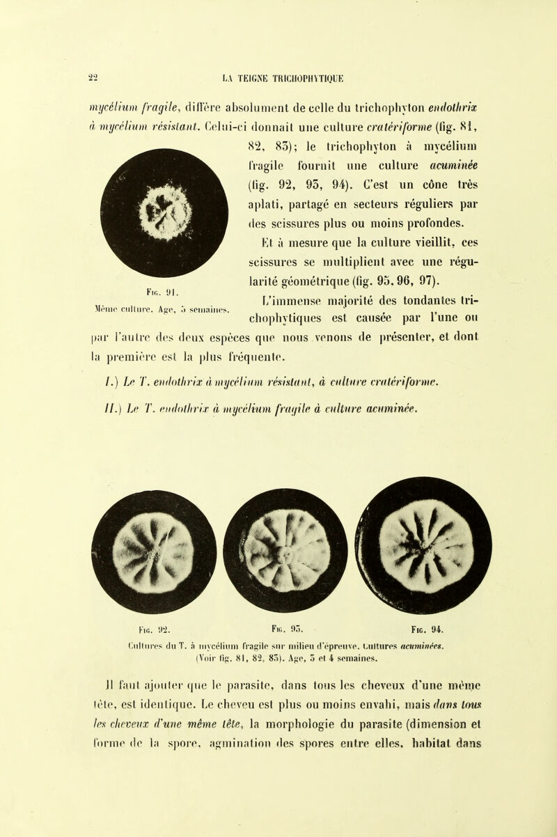 mycélium fragile, dilï'ère absolument de celle du trichophyton endolhrix à mycélium résislatU. (leliii-ci donnait une culture cratériforme (lig. <S1, (S2, 83); le trichophyton à mycélium l'ragile fournit une culture acuminée (lig. 92, 95, 94). C'est un cône très aplati, partagé en secteurs réguliers par <les scissures plus ou moins profondes. Kt à mesure que la culture vieillit, ces scissures se multiplient avec une régu- larité géométrique (lig. 95.96, 97). f/immense majorité des tondantes tri- Mèino ciilliire. Age, spiiiaiiics. ' , chophytiques est causée par 1 une ou |j;ir l'autre des doux espèces que nous venons de [U'éscnter, et dont la première est la pltis fréquente. /.) Le T. evilothrix à mycélium rénistatil, à ciilliire crulériforme. II.) Le l\ eiidotlirix à mycélium fnuiile à culture acuminée. Kifi. 9-2. !>.). FiG. U. (liillnrt's du T. n mycélium fragilo sur milieu fl'éprtMivp. tulturps ncumiiiées. (Voir lip. 81, 82, 85). \go, T) Pl 4 semaines. Jl faut ajonlcr (jwe \o parasite, dans tous les cheveux d'une mènie lèle, est identique. Le cheveu est plus ou moins envahi, mais dor>.^ tous les clu'vevx d'une même lête, la morphologie du parasite (dimension et forme do la spore, agmination des spores entre elles, habitat dans