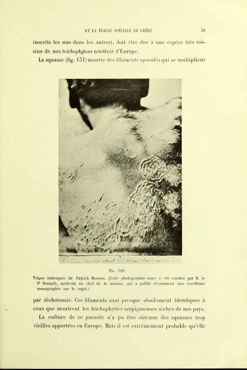 inscrits les uns dans les autres), doit être due à une espèce très voi- sine de nos Irichophylom eclotlirix d'Europe. La squame (fig. loJ) montre des (ilameiits spornlésqui se Miultiplienl Fifi. 129. Teigne imbriquée de Patrick Miinson. (Celte pliotographie lions h été confiée par M. le D' lionnafy, médecin en chef de la maiine, cpii a publié récemment une excellente monographie sur le siijet.^ par dichotomie. Ces (ilaments sojil presque absolument identiques à ceux que montrent les trichophvties scrpigineuses sèches de nos pays. La culture de ce parasite n'a pu être obtenue des squames trop vieilles apportées en Kurope. Mais il est extrêmement probable qu'elle