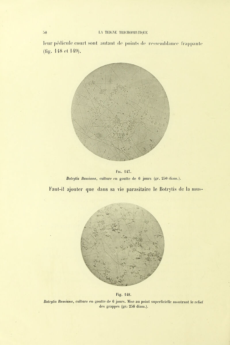 L\ TKK.NH TlIlCIlUI'iniKil !•; loiir pédicule coiii't sont niilar)! de |)()iiils de rcssciiiblaiicc IVappaiilc (Ho-. 148 H, 140). FiG. 147. Bolriitis Bassiana, culture en gouKc de 6 jours (gr. 2.)0 diaiii.). Faut-il ajouter que dans sa vie parasitaire le Botrytis de la unis- P^^IY ■.\.\: v*/^V^lîvr^ Si ■ \ . Fig. 148. BolrijUs Bnssiano, cuKurc en goutte de C jours. Mise au point superficielle montrant le relief des grappes (gr.- 250 diam.).