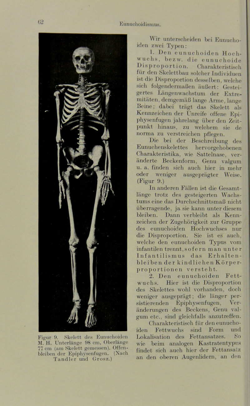 G2 Figur 9. .Skelett des p]unuchoiden M. H. Unterlänge 98 cm, Überlänge 77 cm (am Skelett gemessen). Offen- bleiben der Epiphysenfugen. (Nach Tandler und Grosz.) Wir unterscheiden bei Eunucho- iden zwei Typen: 1. Den eunuchoiden Hoch- wuchs, bezw. die eunuchoide Disproportion. Charakteristisch für den Skelettbau solcher Individuen ist die Disproportion desselben, welche sich folgendermaßen äußert: Gestei- gertes LcängenWachstum der f]xtre- mitäten, demgemäß lange Arme, lange Beine; dabei trägt das Skelett als Kennzeichen der Unreife offene Epi- physenfugen jahrelang über den Zeit- punkt hinaus, zu welchem sie de norma zu verstreichen pflegen. Die bei der Beschreibung des Eunuchenskelettes hervorgehobenen Charakteristika, wie Sattelnase, ver- änderte Beckenform, Genu valgum u. a. finden sich auch hier in mehr oder weniger ausgeprägter Weise. (Figur 9.) In anderen Fällen ist die Gesamt- länge trotz des gesteigerten Wachs- tums eine das Durchschnittsmaß nicht überragende, ja sie kann unter diesem bleiben. Dann verbleibt als Kenn- zeichen der Zugehörigkeit zur Gruppe des eunuchoiden HochA\Tichses nur die Disproportion. Sie ist es auch, welche den eunuchoiden Typus vom infantilen trennt,sofern man unter Infantilismus das Erhalten- bleiben der kindlichen Körper- proportionen versteht. 2. Den eunuchoiden Fett- wuchs. Hier ist die Disjjroportion des Skelettes wohl vorhanden, doch weniger ausgeprägt; die länger per- sistierenden Epi]3hysenfugen, Ver- änderungen des Beckens, Genu val- gum etc., sind gleichfalls anzutreffen. Charakteristisch für den eunucho- iden Fettwuchs sind Form und Lokalisation des Fettansatzes. So wie beim analogen Kastratentypus findet sich auch hier der Fettansatz an den oberen Augenlidern, an den