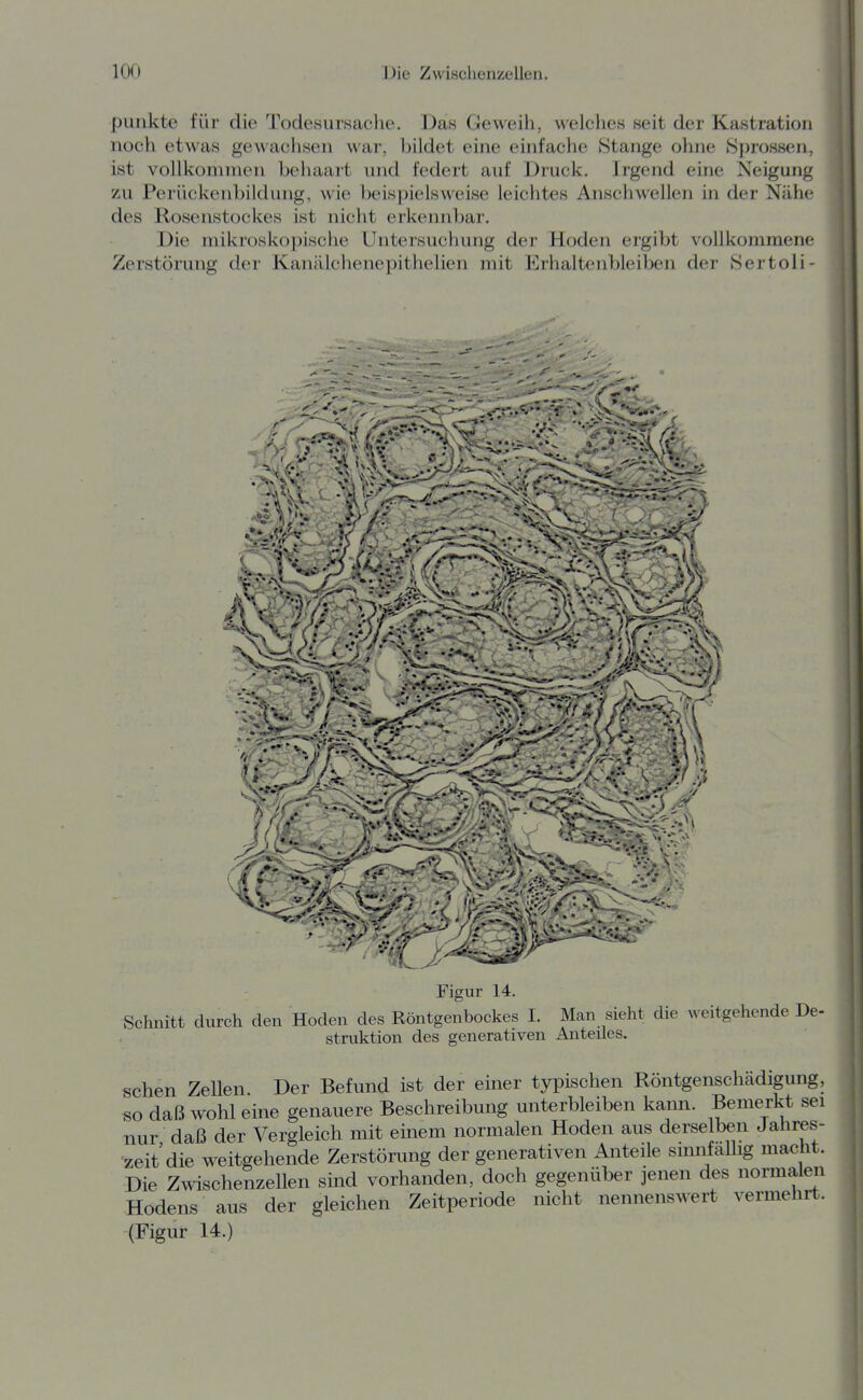 punkte für die Todesursache. Das Geweih, welclies seit der Kastration noch etwas gewachsen war, bildet eine einfache Stange ohne »Sprossen, ist vollkommen behaart und federt auf Druck. Irgend eine Neigung zu Perückenbildung, wie beispielsweise leichtes Anschwellen in der Nähe des Rosenstockes ist nicht erkennbar. Die mikroskopische Untersuchung der Hoden ergibt vollkommene Zerstörung der Kanälchenepithelien mit Erhaltenbleiben der Sertoli- <C#< ^.W' ... . - . . ,^ . - Figur 14. Schnitt durch den Hoden des Röntgenbockes I. Man sieht die weitgehende De- struktion des generativen Anteiles. sehen Zellen Der Befund ist der einer typischen Röntgenschädigung, so daß wohl eine genauere Beschreibung unterbleiben kann. Bemerkt sei nur daß der Vergleich mit einem normalen Hoden aus derselben Jahres- zeit die weitgehende Zerstörung der generativen Anteile smnfaUig macht. Die Zwischenzellen sind vorhanden, doch gegenüber jenen des normalen Hodens aus der gleichen Zeitperiode nicht nennenswert vermehrt. (Figur 14.)