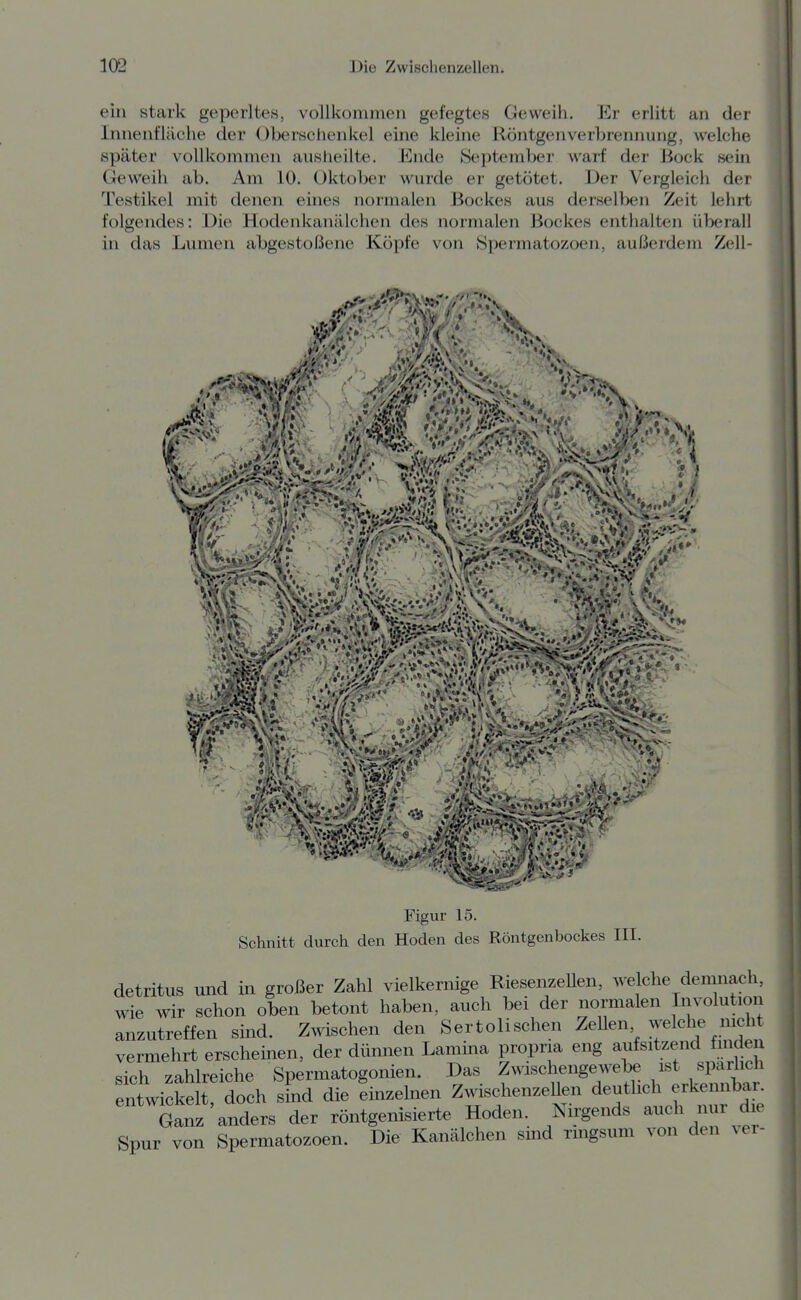 ein stark geperltes, vollkommen gefegtes Geweih. Er erlitt an der Innenfläche der Oberschenkel eine kleine Röntgenverbrennung, welche später vollkommen auslieilte. Ende September warf der Bock sein Geweih ab. Am 10. Oktober wurde er getötet. Der Vergleich der Testikel mit denen eines normalen Bockes aus derselben Zeit lehrt folgendes: Die Hodenkanälchen des normalen Bockes enthalten überall in das Linnen abgestoßene Köpfe von 8permatozoen, außei'dem Zell- ..ii »I '-Vt.' k '•Vi Figur 15. Schnitt durch den Hoden des Röntgenbockes III. detritus und in großer Zahl vielkernige Riesenzellen, welche demnach, wie wir schon oben betont haben, auch bei der normalen Iiivolution anzutreffen sind. Zwischen den Sertolischen ZeUen welche mch vermehrt erscheinen, der dünnen Lamina propna eng aufsitzend fmden sich zahlreiche Spermatogonien. Das Zwischengewebe ist spärlich entwickelt, doch sind die emzelnen Zwischenzellen deutlich erkennbar Ganz anders der röntgenisierte Hoden. Nirgends auch nur die Spur von Spermatozoen. Die Kanälchen sind rmgsum von den ver-